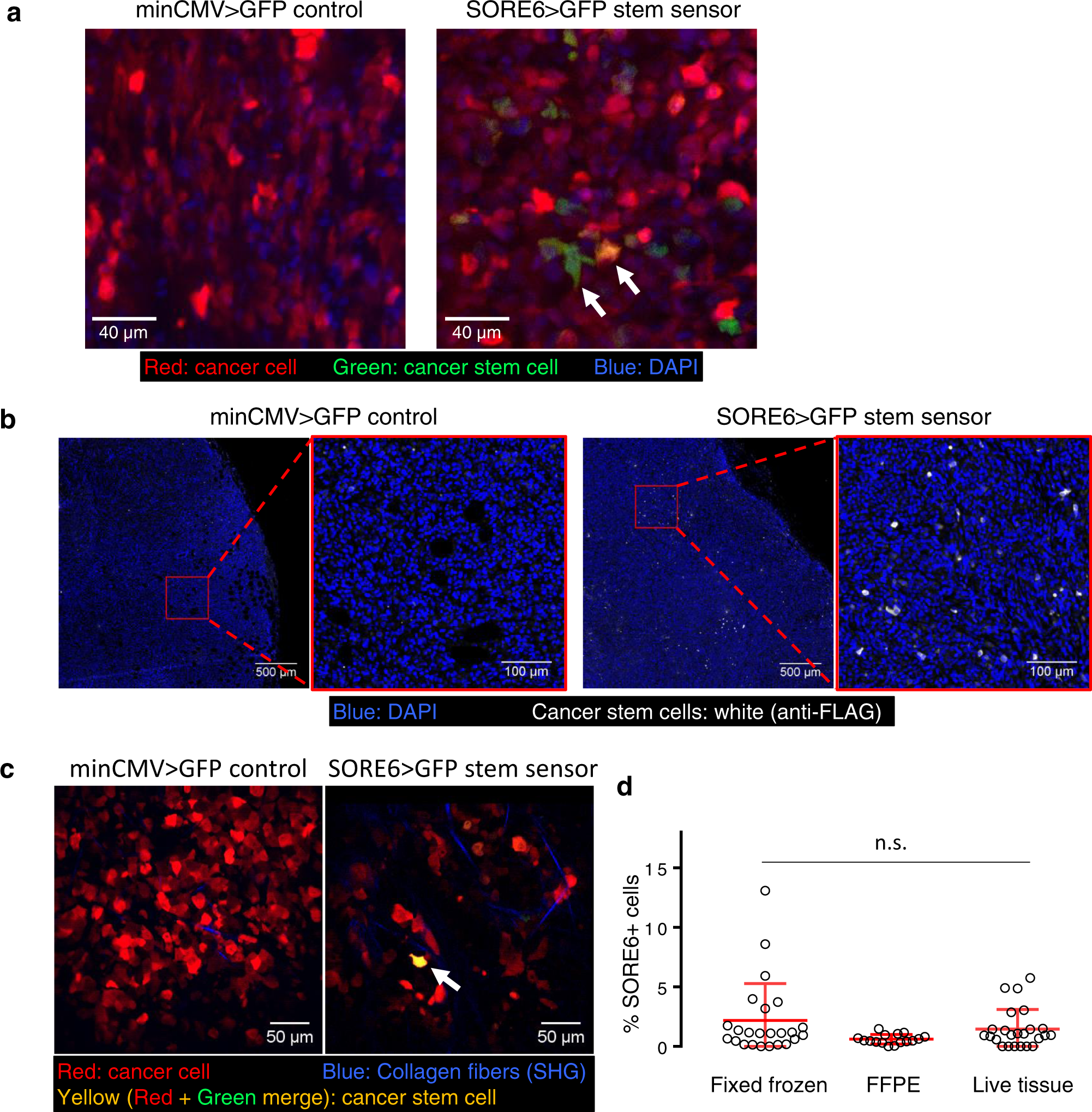 Live tumor imaging shows macrophage induction and TMEM-mediated enrichment  of cancer stem cells during metastatic dissemination | Nature Communications