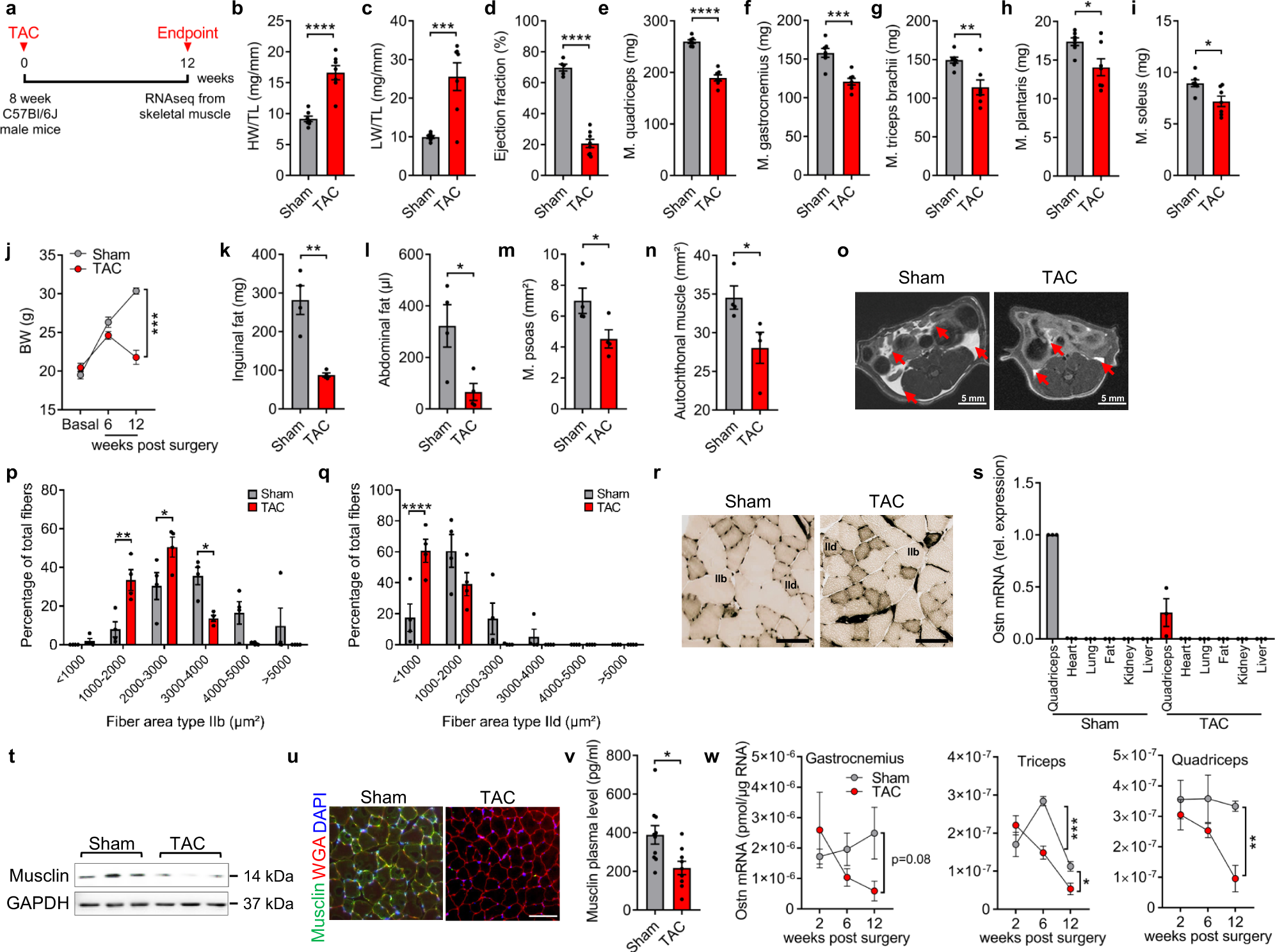 Fig. 1: Musclin expression decreases in wasting skeletal muscles during advanced heart failure.