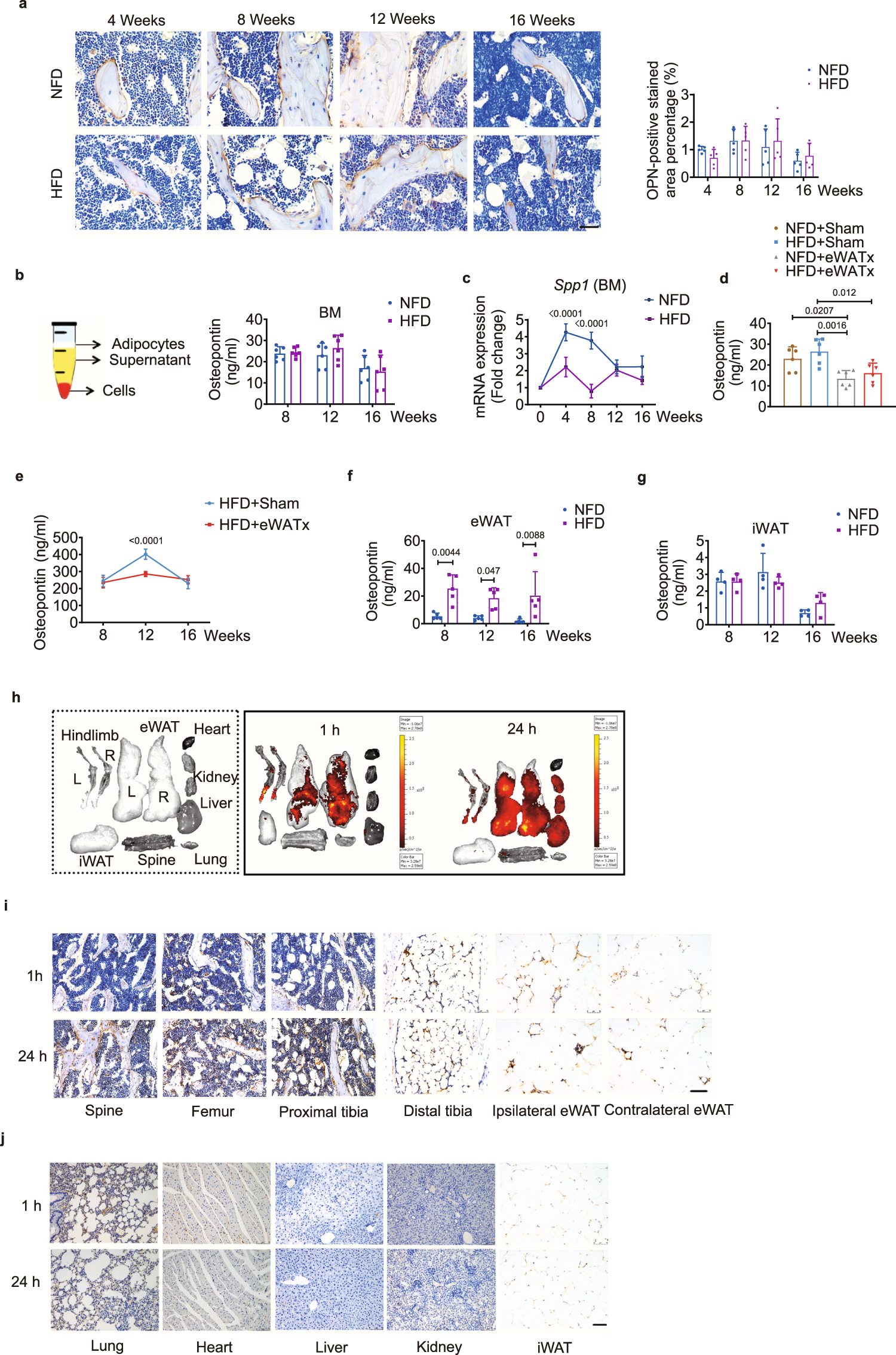 Fig. 6: eWAT-secreted OPN circulates to the bone marrow.