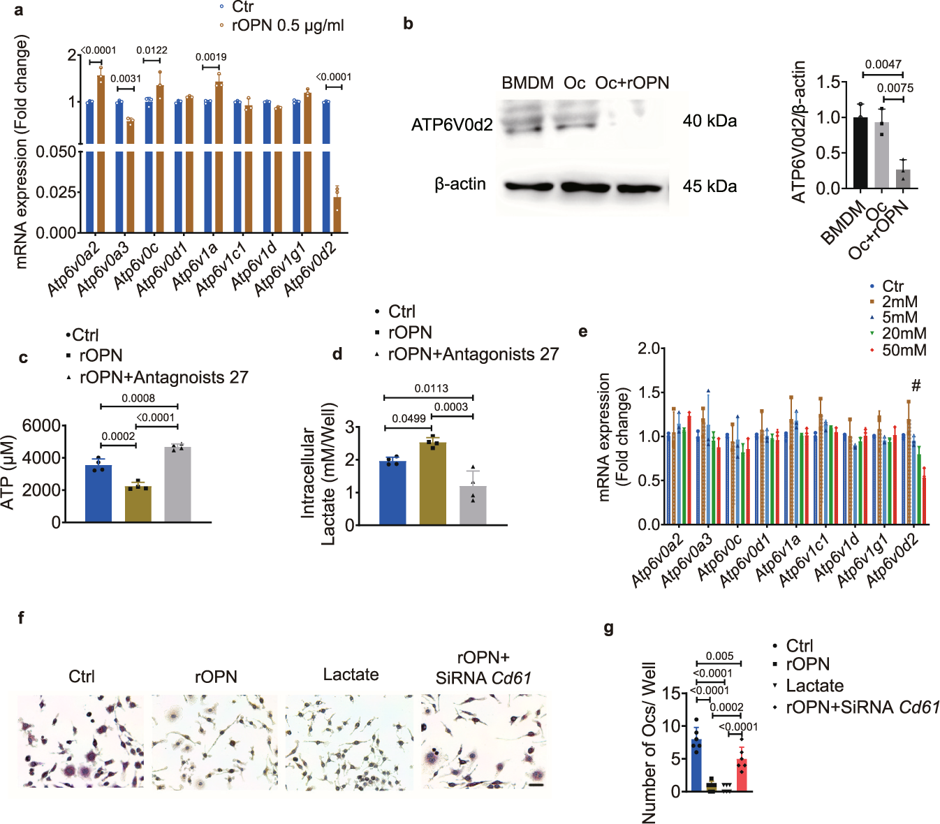 Fig. 8: Osteopontin regulates bone marrow-derived macrophages through the lactate/ATP6V0d2 axis.