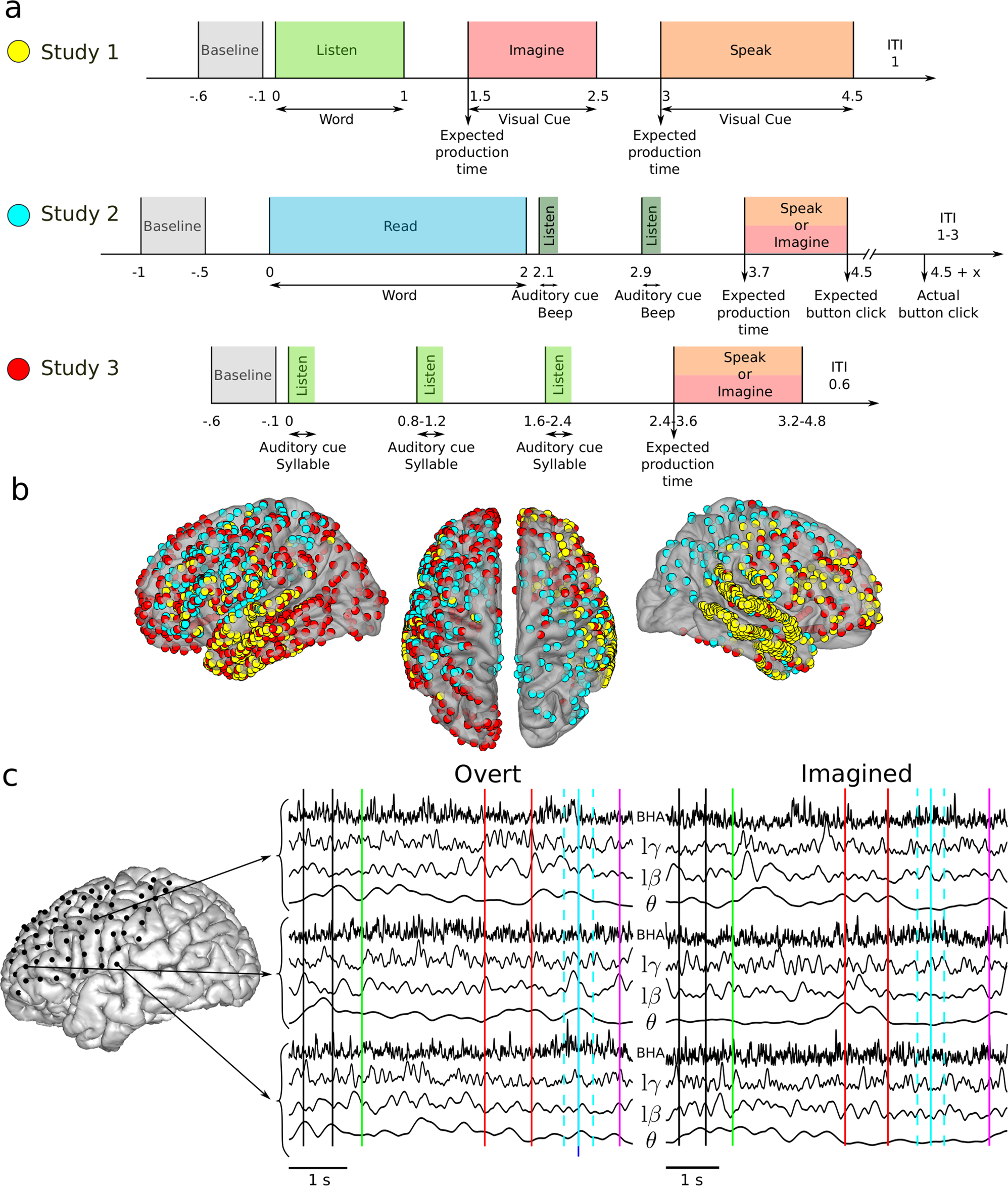 Imagined Speech Can Be Decoded From Low And Cross Frequency Intracranial Eeg Features Nature Communications