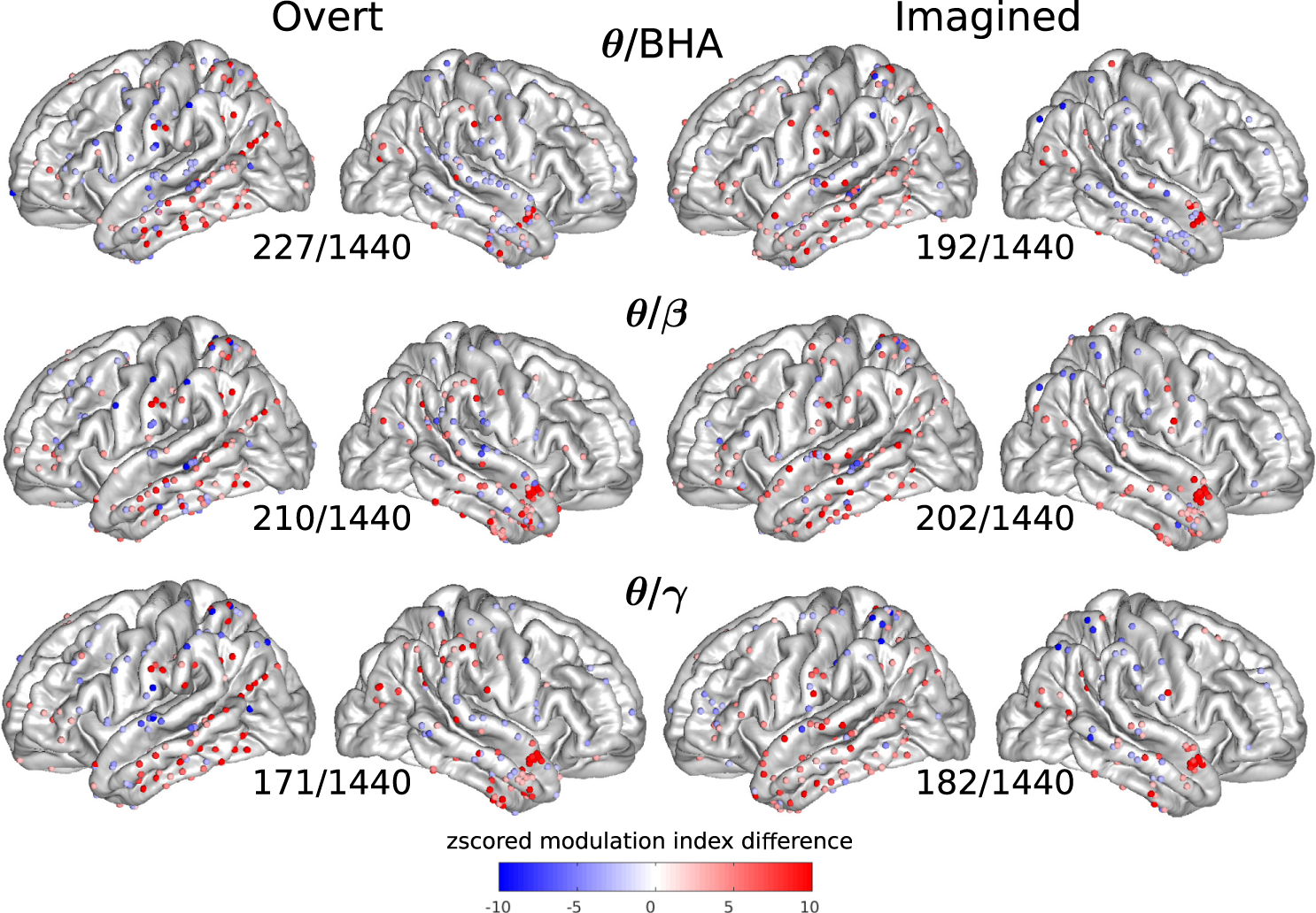 Fig. 3: Cross-frequency coupling (CFC) between the phase of one frequency band and the amplitude of another (higher) frequency band for each electrode.