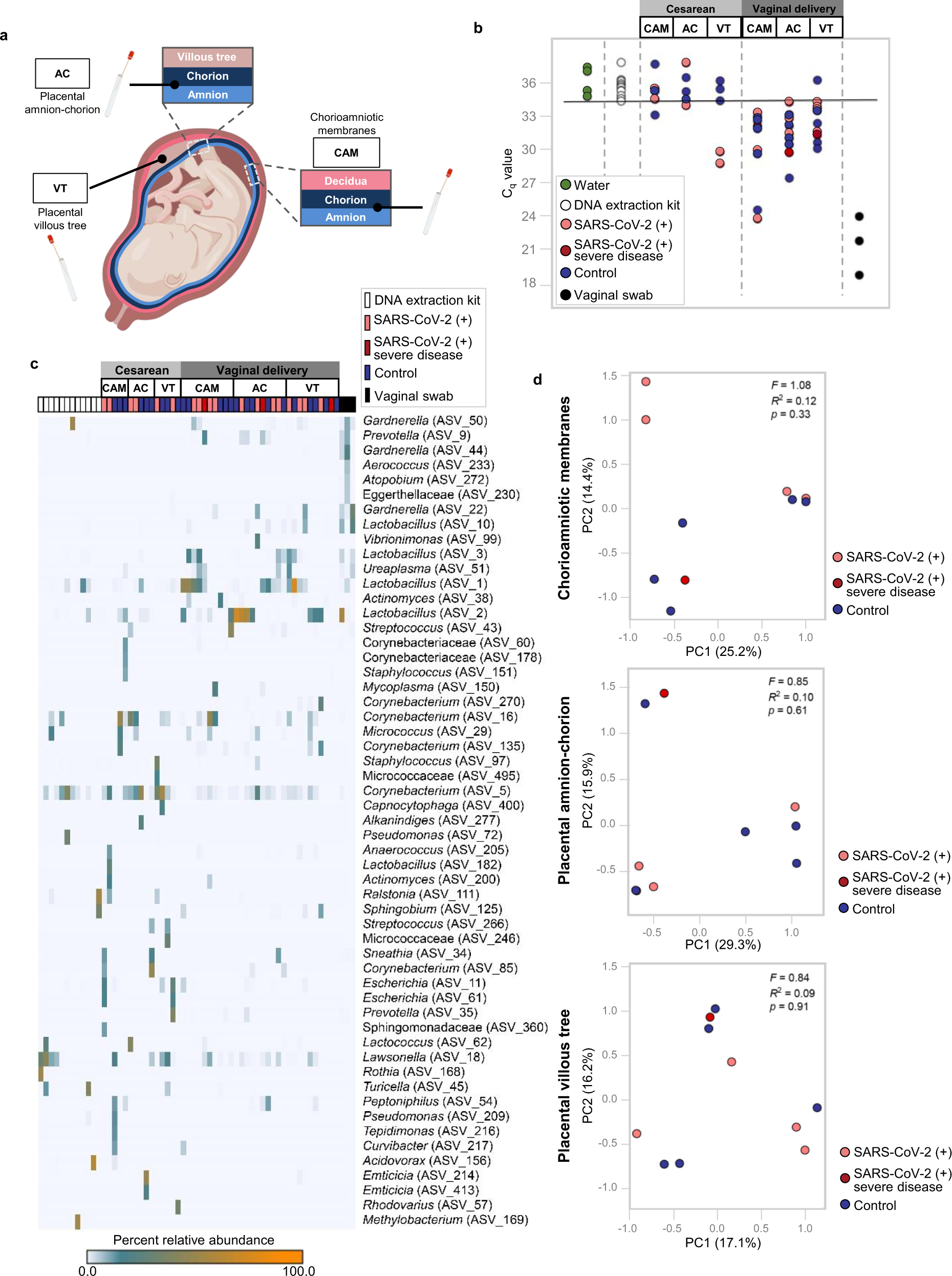 Fig. 8: Bacterial DNA profiles of the placental tissues from women with SARS-CoV-2 infection.