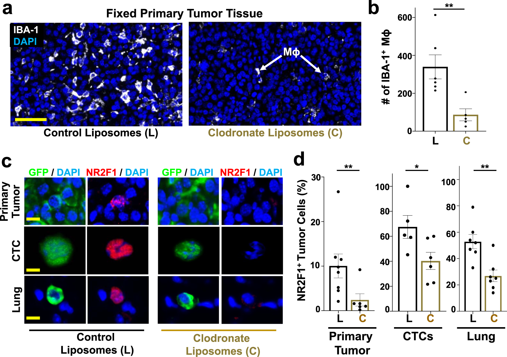 Fig. 8: Macrophage depletion reduces dormancy in primary tumors, CTCs, and disseminating tumor cells in vivo.