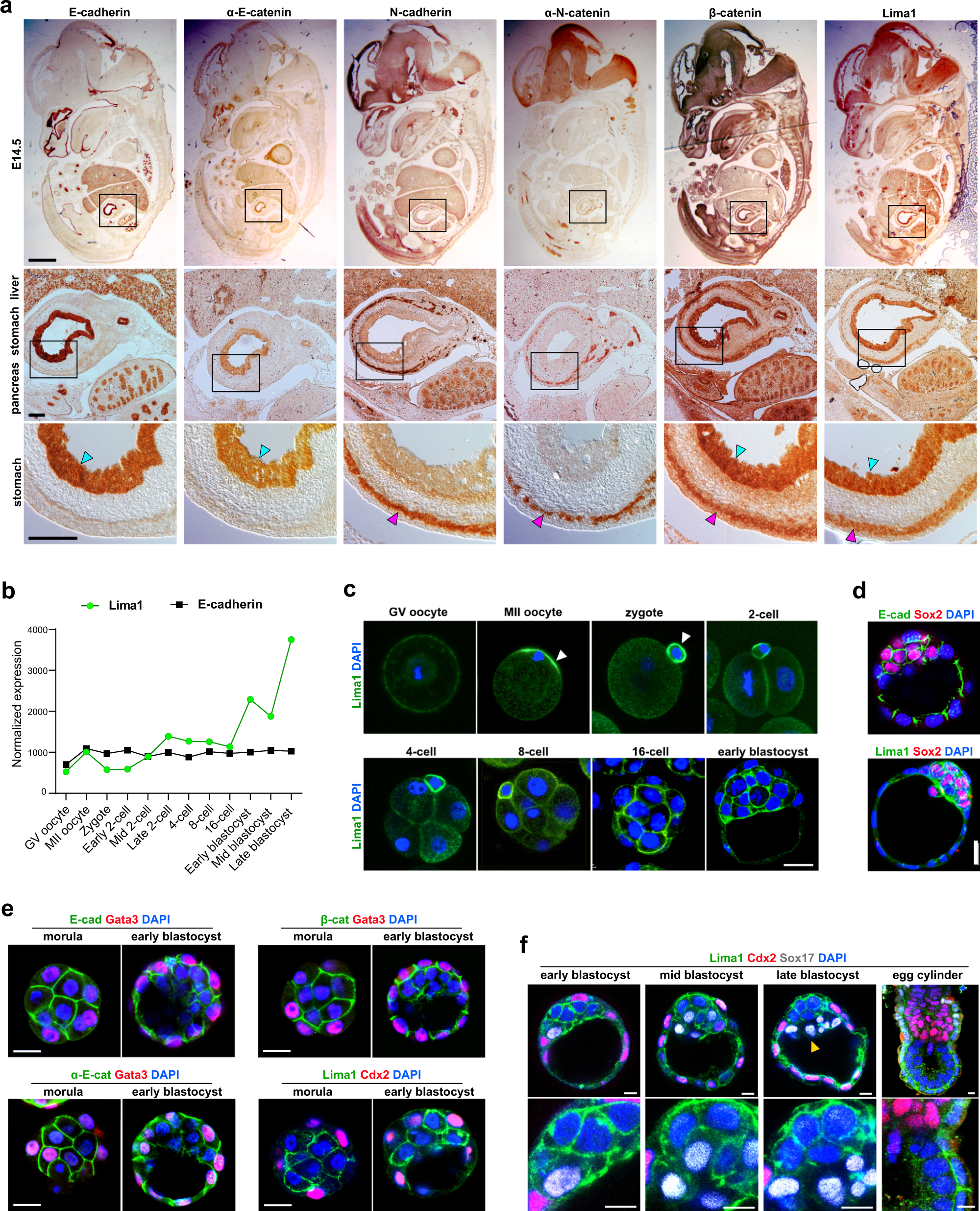 Lima1 mediates the pluripotency control of membrane dynamics and cellular  metabolism | Nature Communications