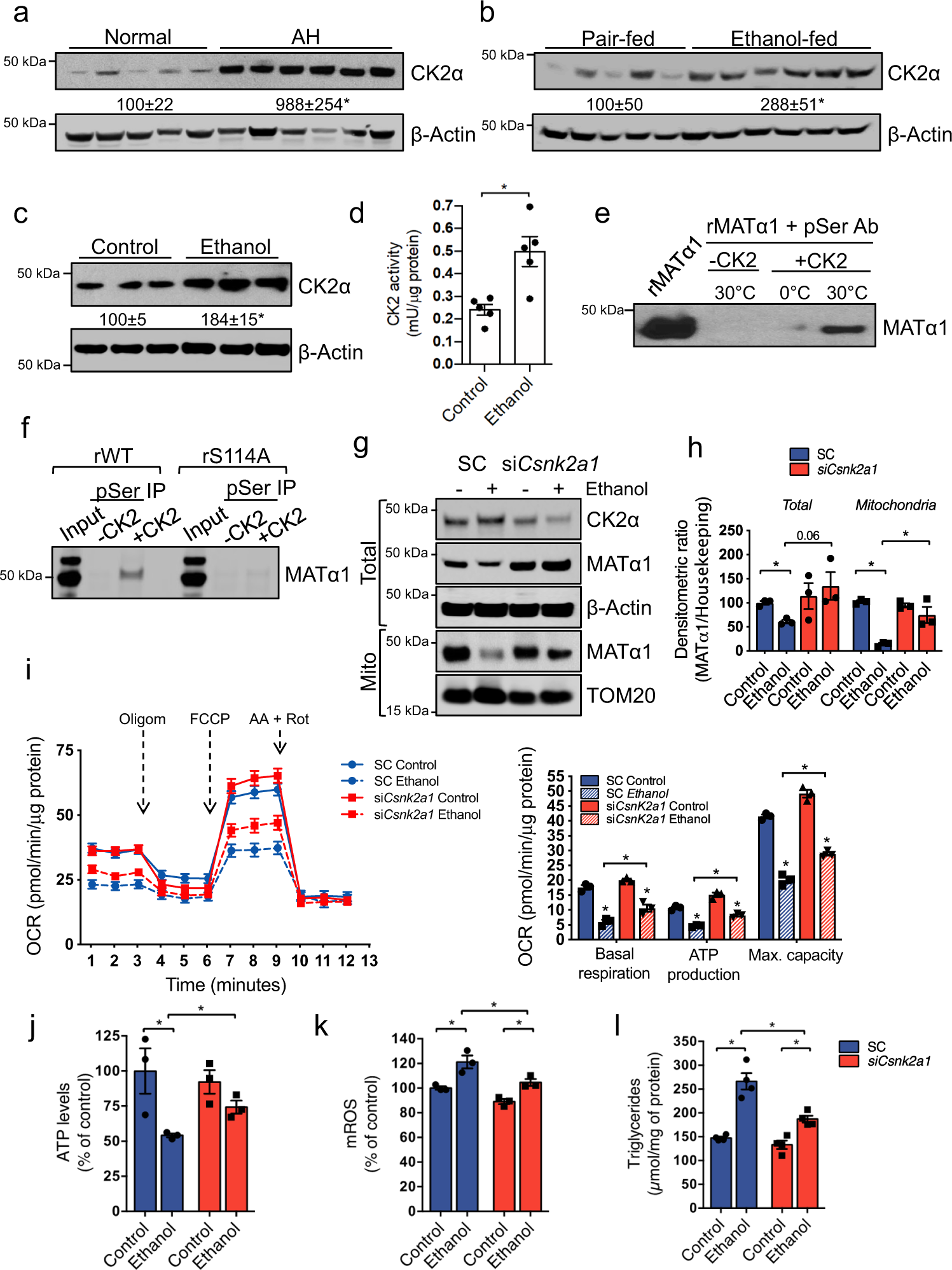 Fig. 7: CK2 phosphorylates MATα1 at Ser114 to inhibit its mitochondrial localization in ALD.