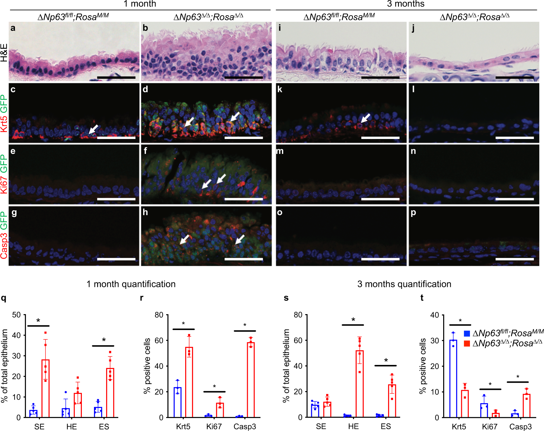 Fig. 2: In vivo ΔNp63 ablation in the tracheal epithelium results in acute increased proliferation leading to long-term depletion of Krt5+ basal cells.