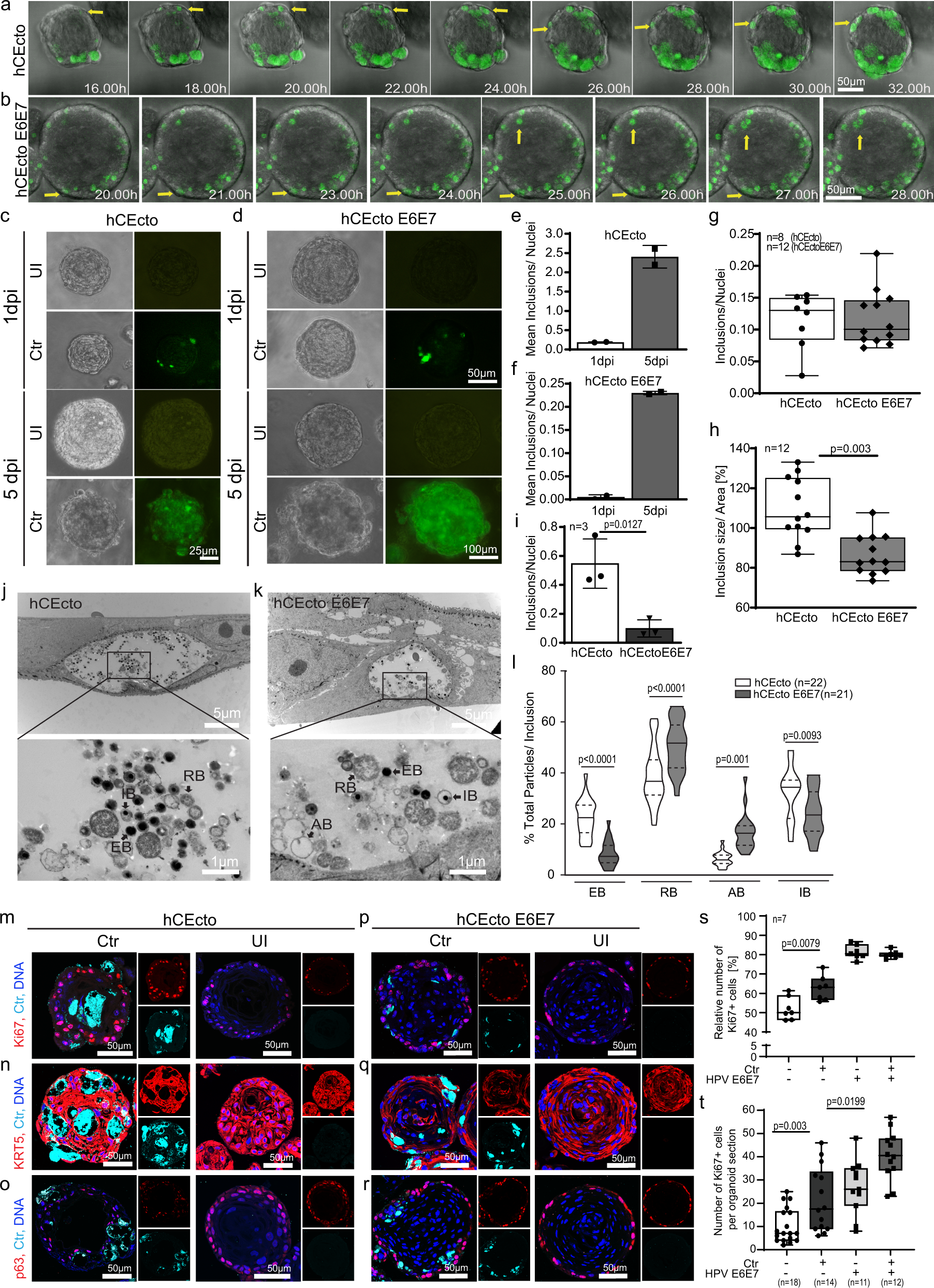 Fig. 2: Modelling HPV16 E6E7 integration and C. trachomatis coinfection in ectocervical organoids.