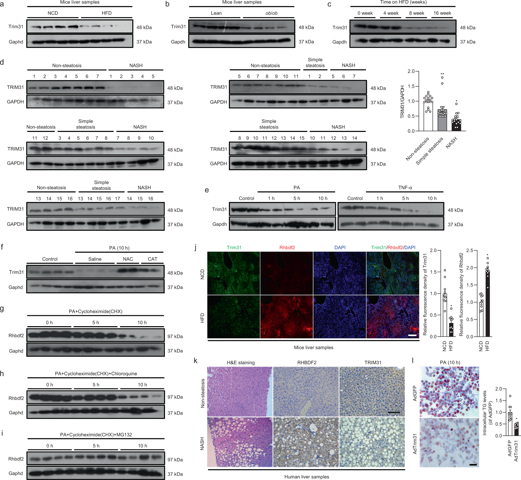 Fig. 1: Trim31 expression is restrained in the livers with hepatic steatosis.
