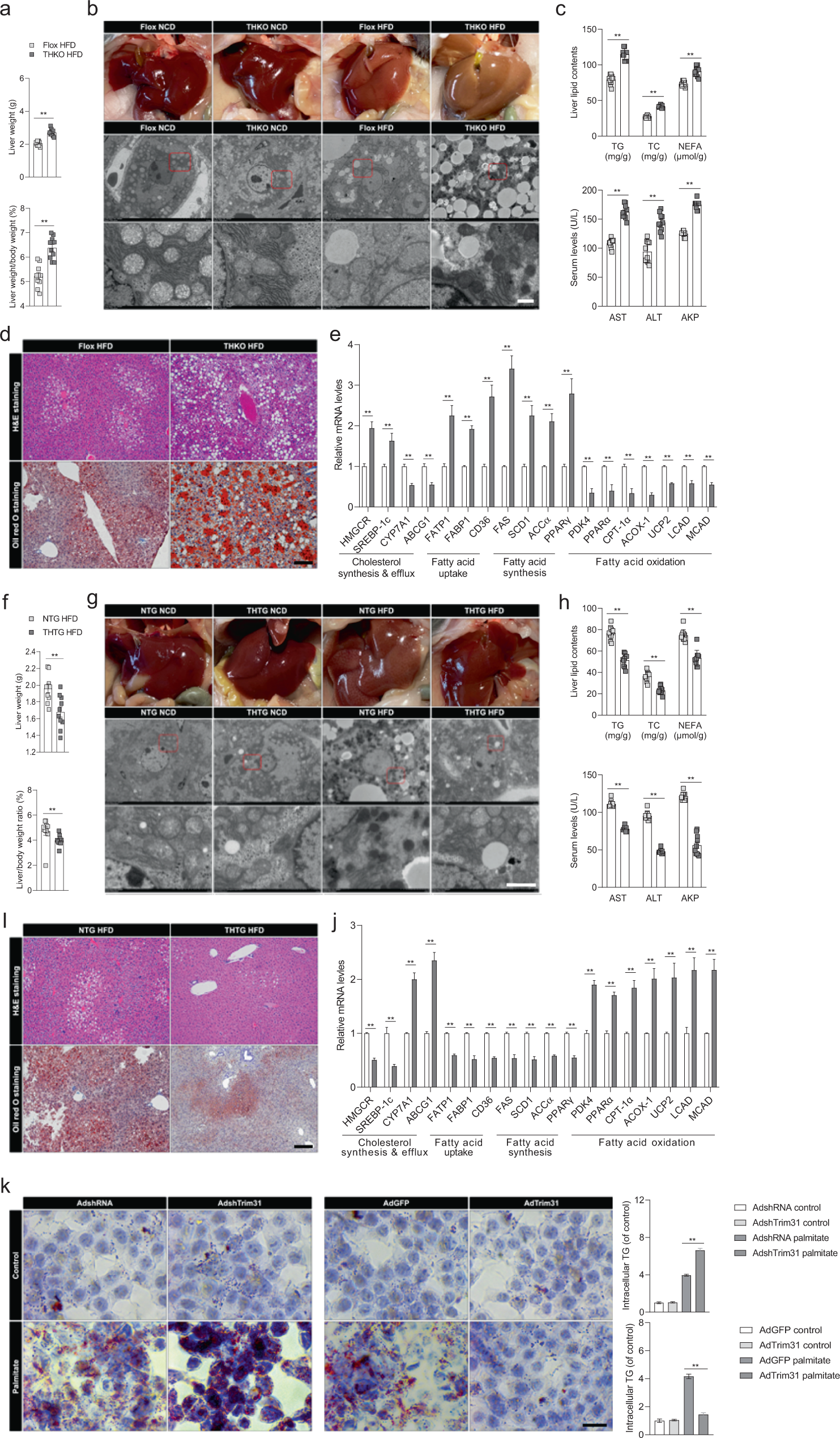 Fig. 3: Functional loss of hepatic Trim31 aggravates HFD-induced hepatic steatosis.