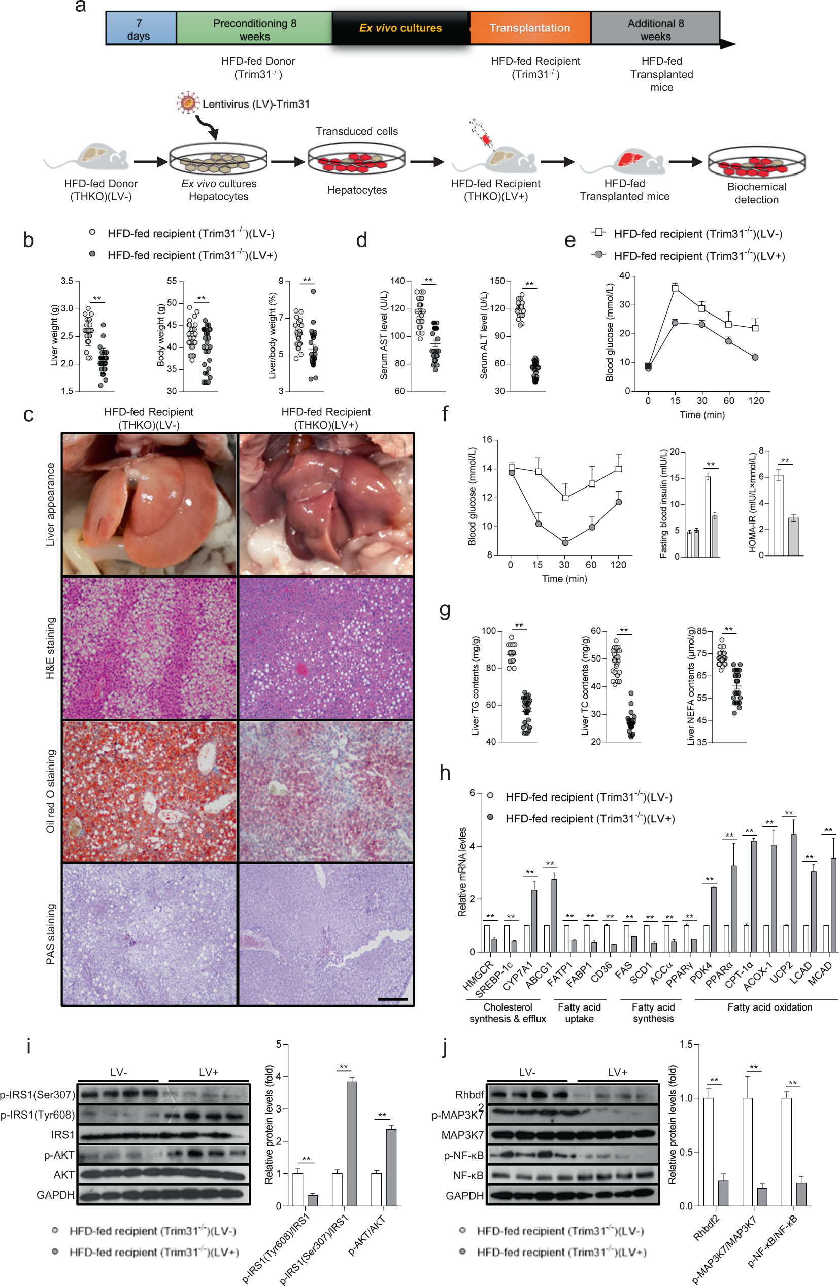 Fig. 4: Allogeneic hepatocyte transplantation using lentivirus-mediated Trim31 expression alleviates HFD-triggered hepatic steatosis, insulin resistance, and inflammation.