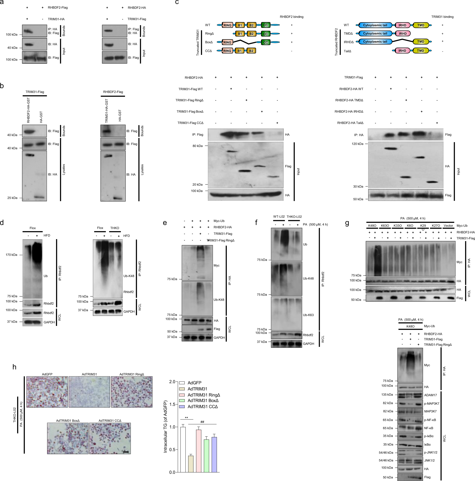 Fig. 6: TRIM31 interacts with RHBDF2 and mediates degradation of Rhbdf2 by K48-linked polyubiquitination.
