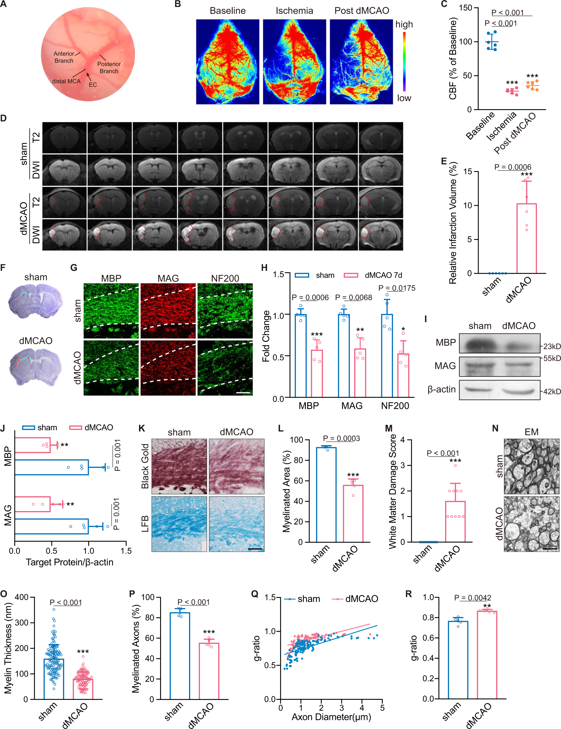 Stroke subtype-dependent synapse elimination by reactive gliosis in mice