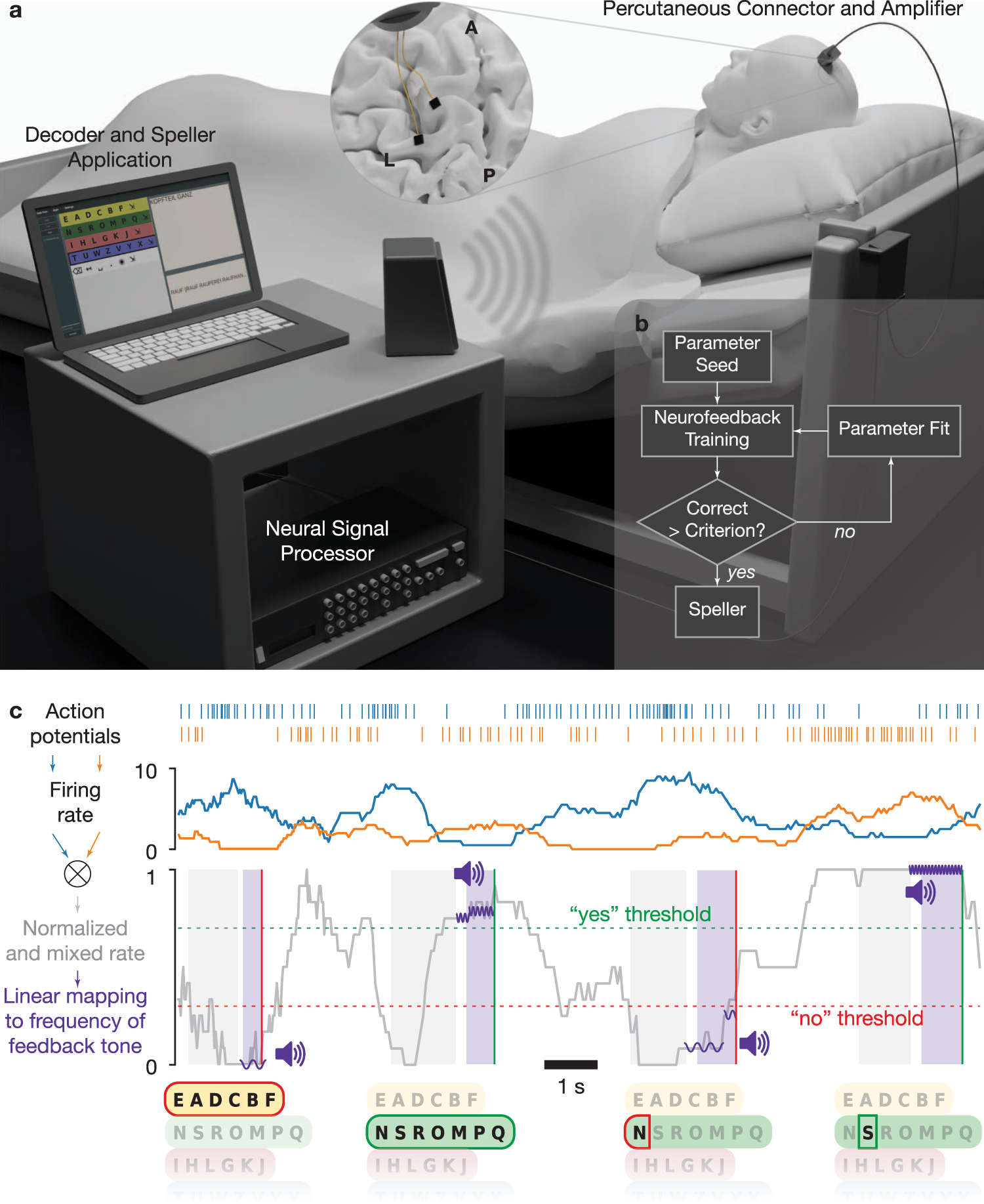 Spelling interface using intracortical signals in a completely locked-in  patient enabled via auditory neurofeedback training | Nature Communications