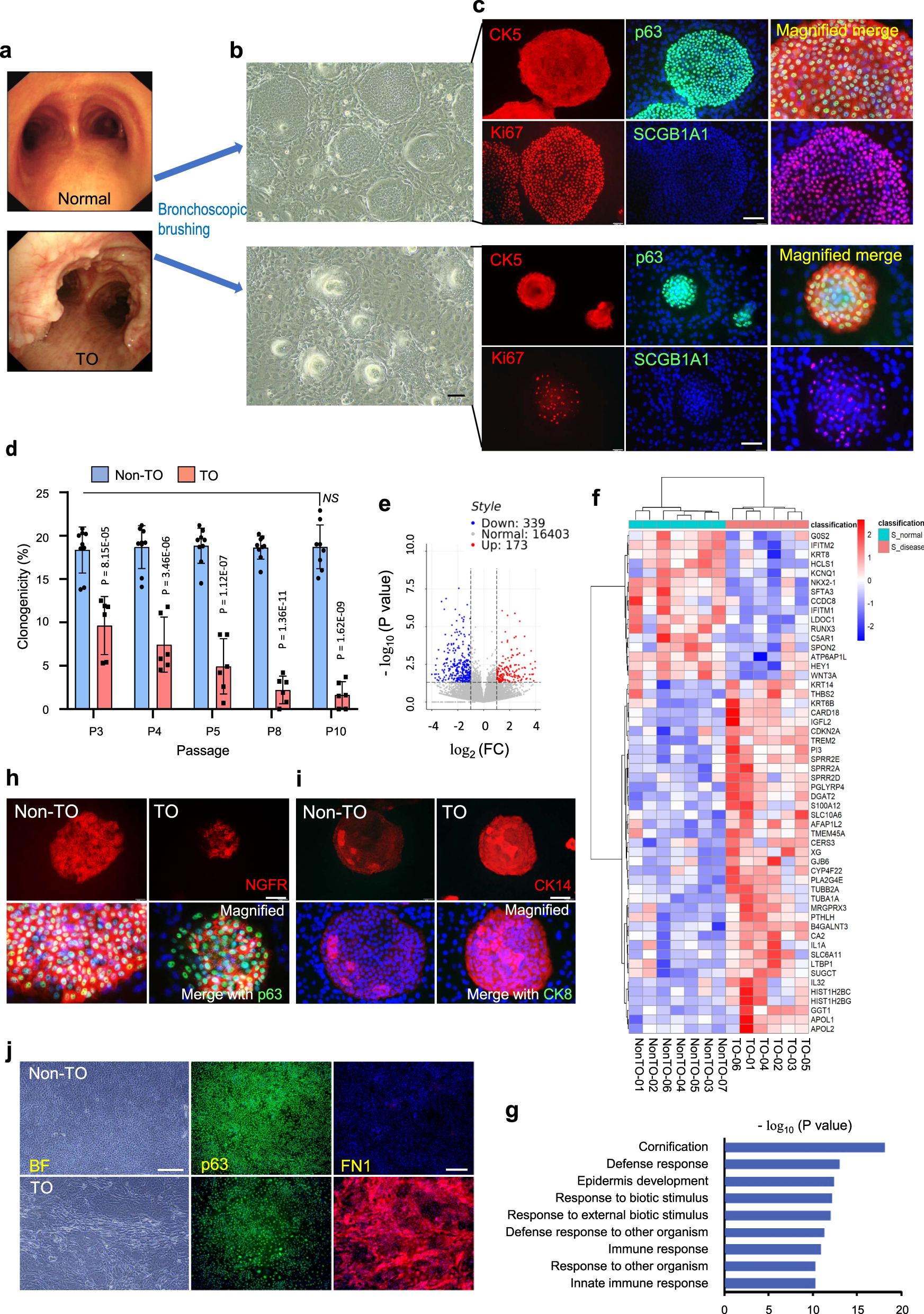 Fig. 1: Tracheal-bronchial basal cell (TBBC) isolation and characterization.
