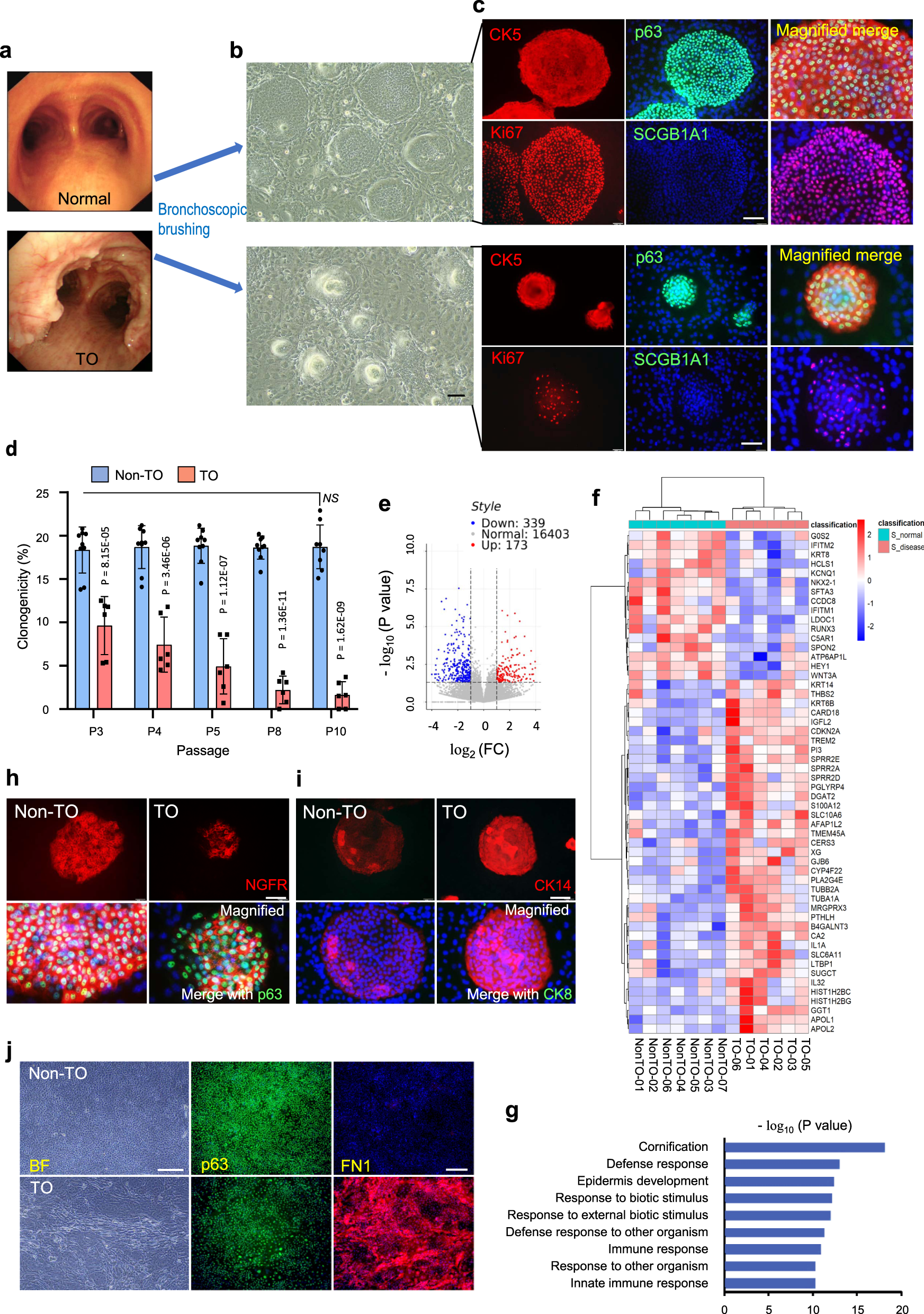 Malfunction of airway basal stem cells plays a crucial role in  pathophysiology of tracheobronchopathia osteoplastica | Nature  Communications
