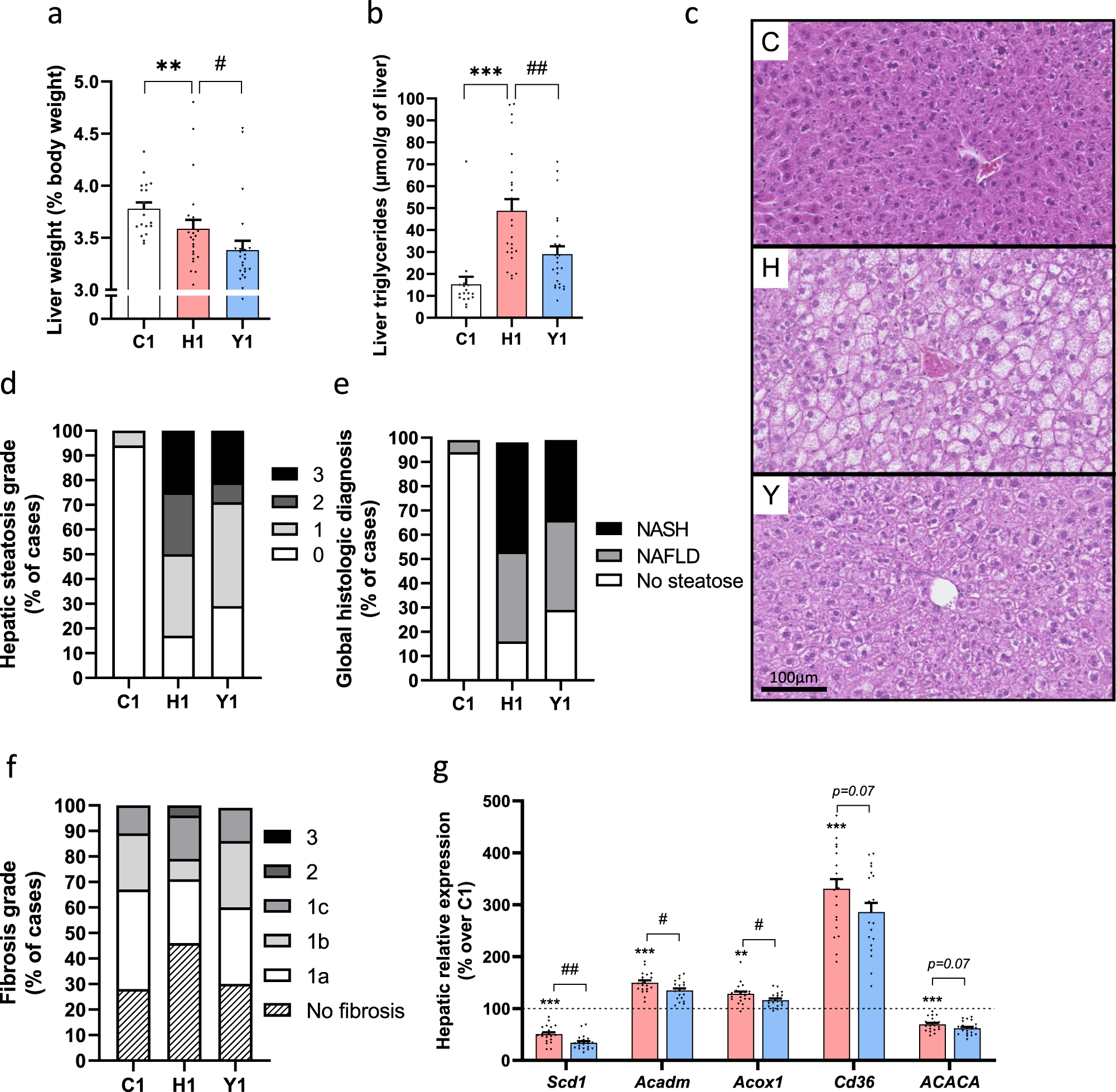 Fig. 2: Yogurt preserves hepatic steatosis and function.