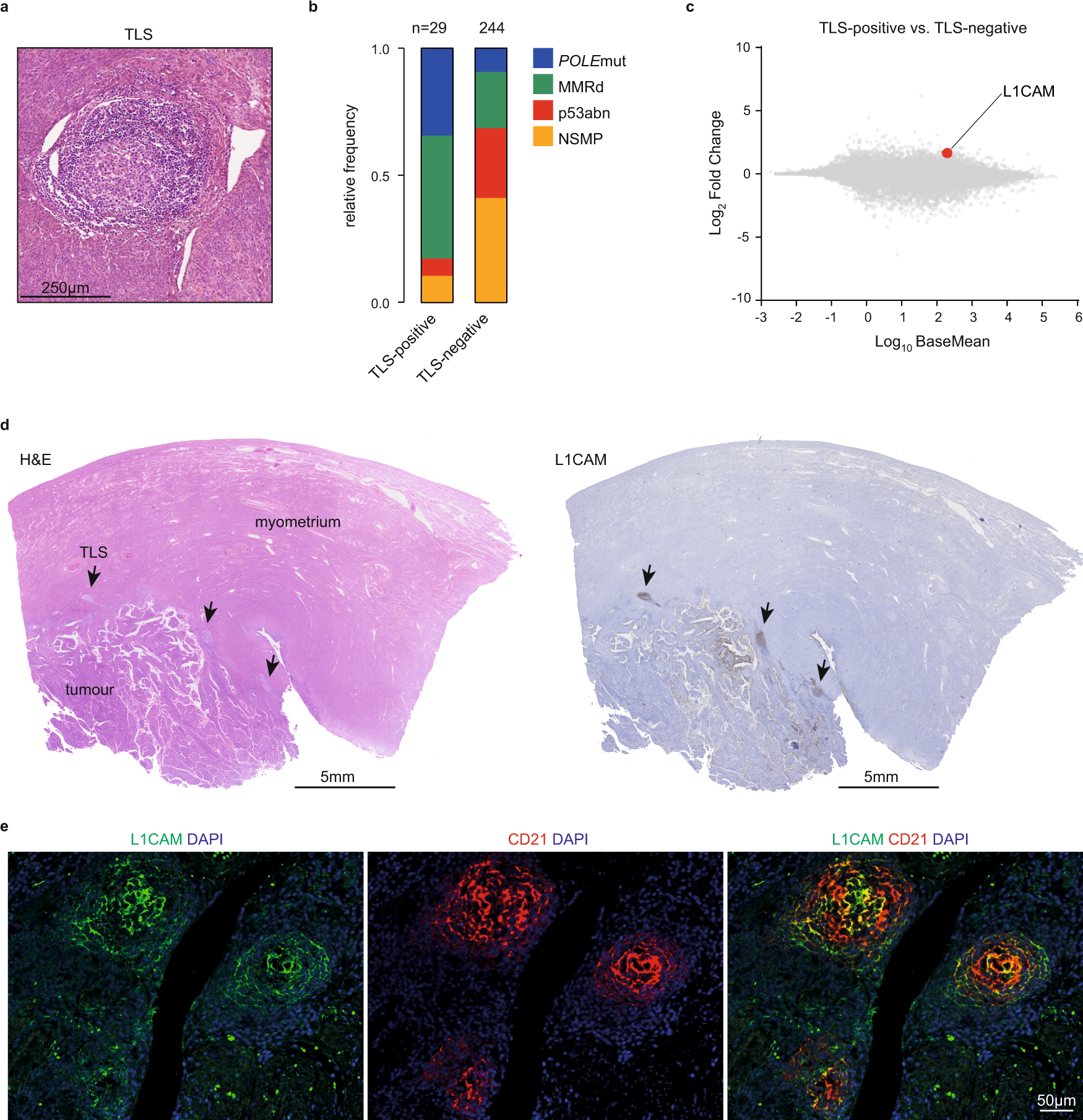 Fig. 2: L1CAM expression in mature germinal centers of tertiary lymphoid structures.