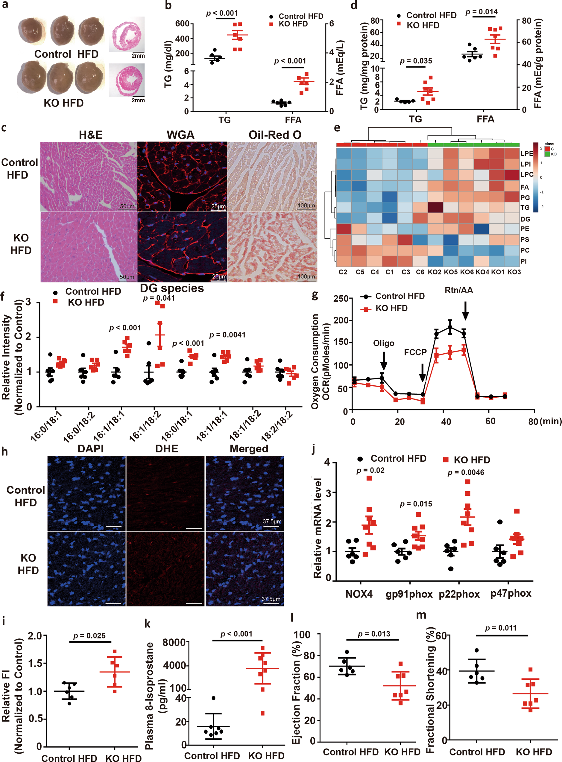 Fig. 5: BBOX deficiency leads to cardiac hypertrophy, lipid accumulation, and oxidative stress.