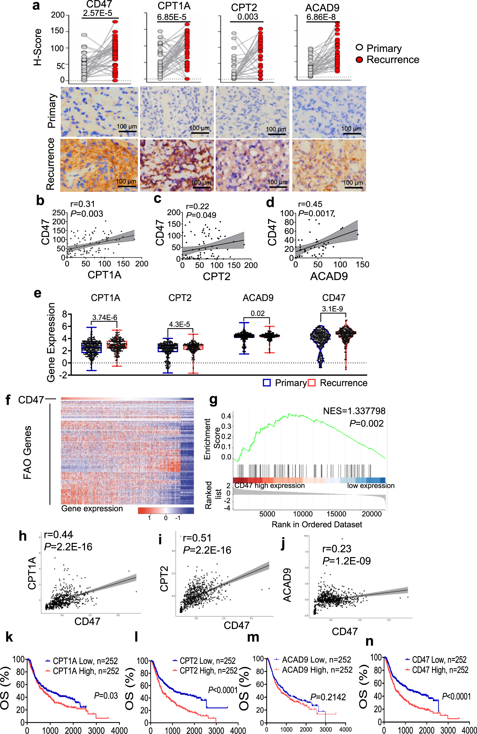 Fig. 1: Co-enhancement of FAO enzymes and CD47 links to the recurrent GBM patients and poor prognosis.