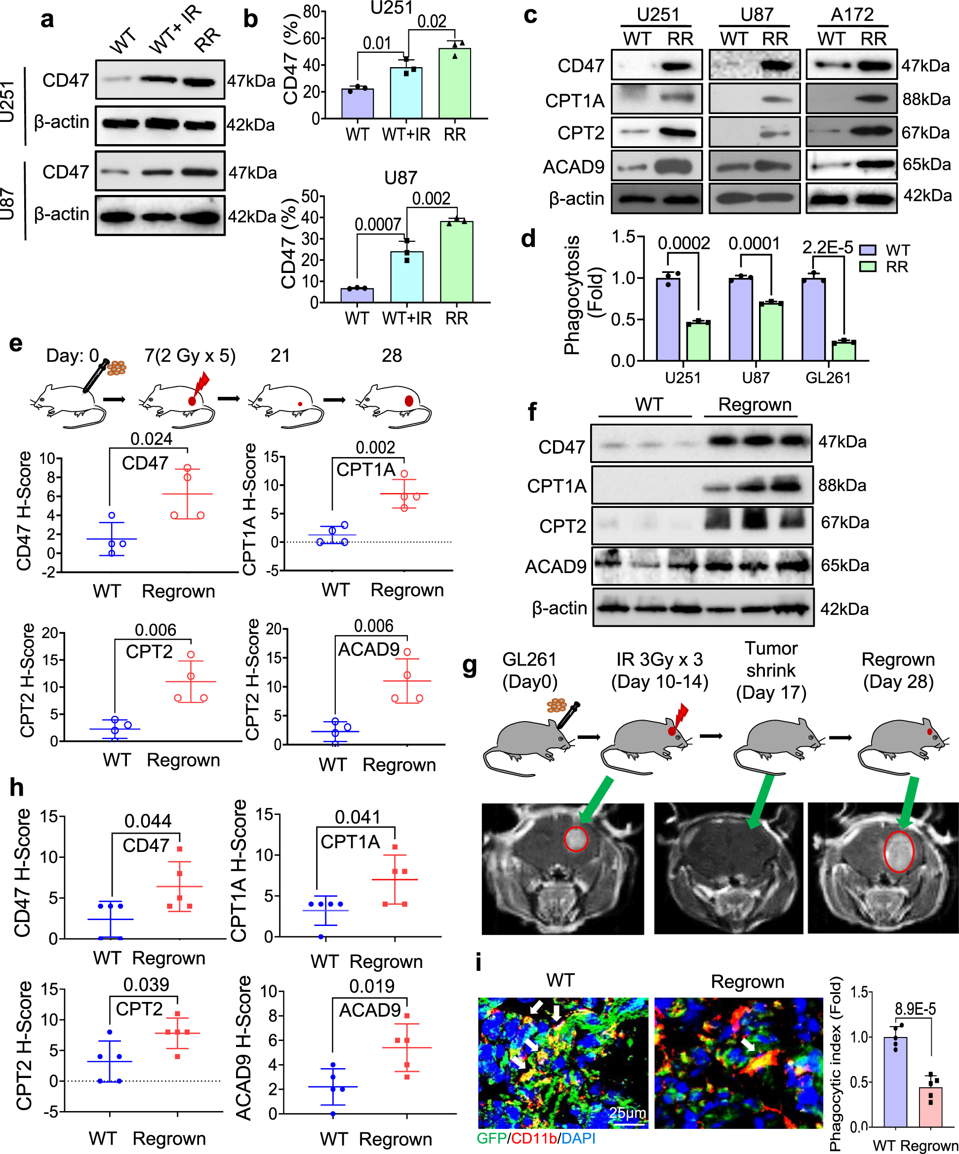 Fig. 3: Activation of FAO and CD47 with anti-phagocytosis in RR GBM cells and regrown tumors.
