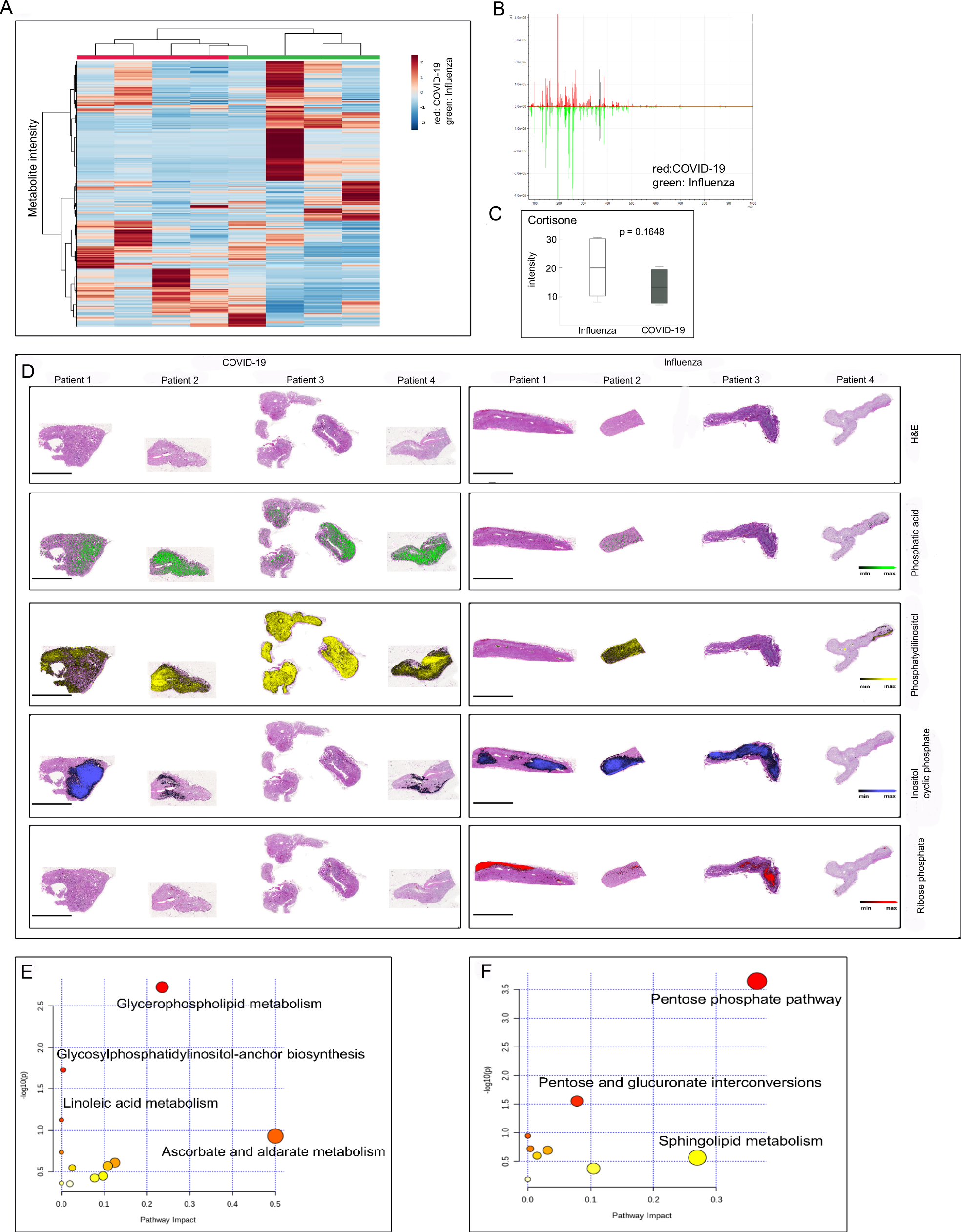 Fig. 6: Distinct metabolomics phenotype of adrenal glands from COVID-19 patients.