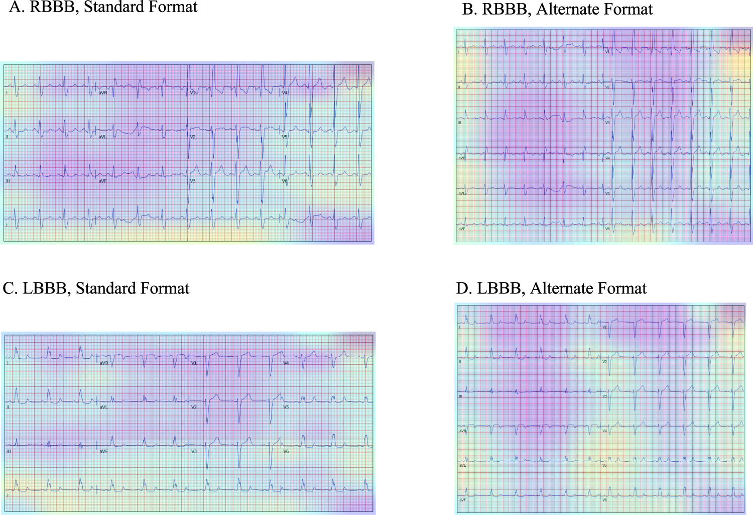Fig. 5: Gradient-weighted Class Activation Maps for Image Predictions.