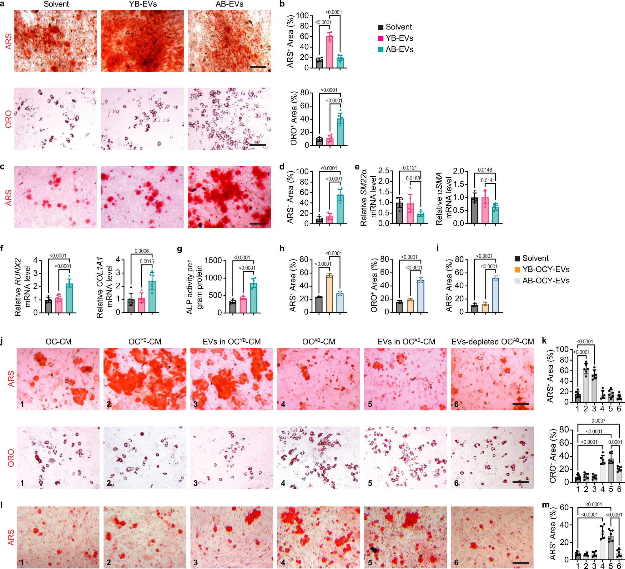 Fig. 2: AB-EVs favor adipogenesis rather than osteogenesis of BMSCs and augment osteogenic transdifferentiation of VSMCs.