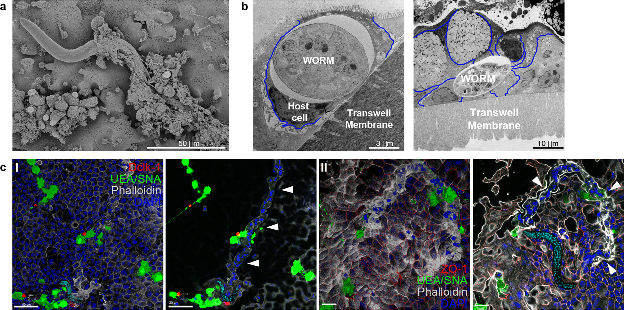 Fig. 4: Caecaloid—T. muris in vitro model reveals intricate path of multi-intracellular tunnels burrowed by whipworm L1 larvae.