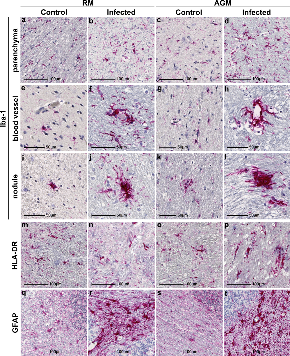 Neuropathology and virus in brain of SARS-CoV-2 infected non-human primates  | Nature Communications