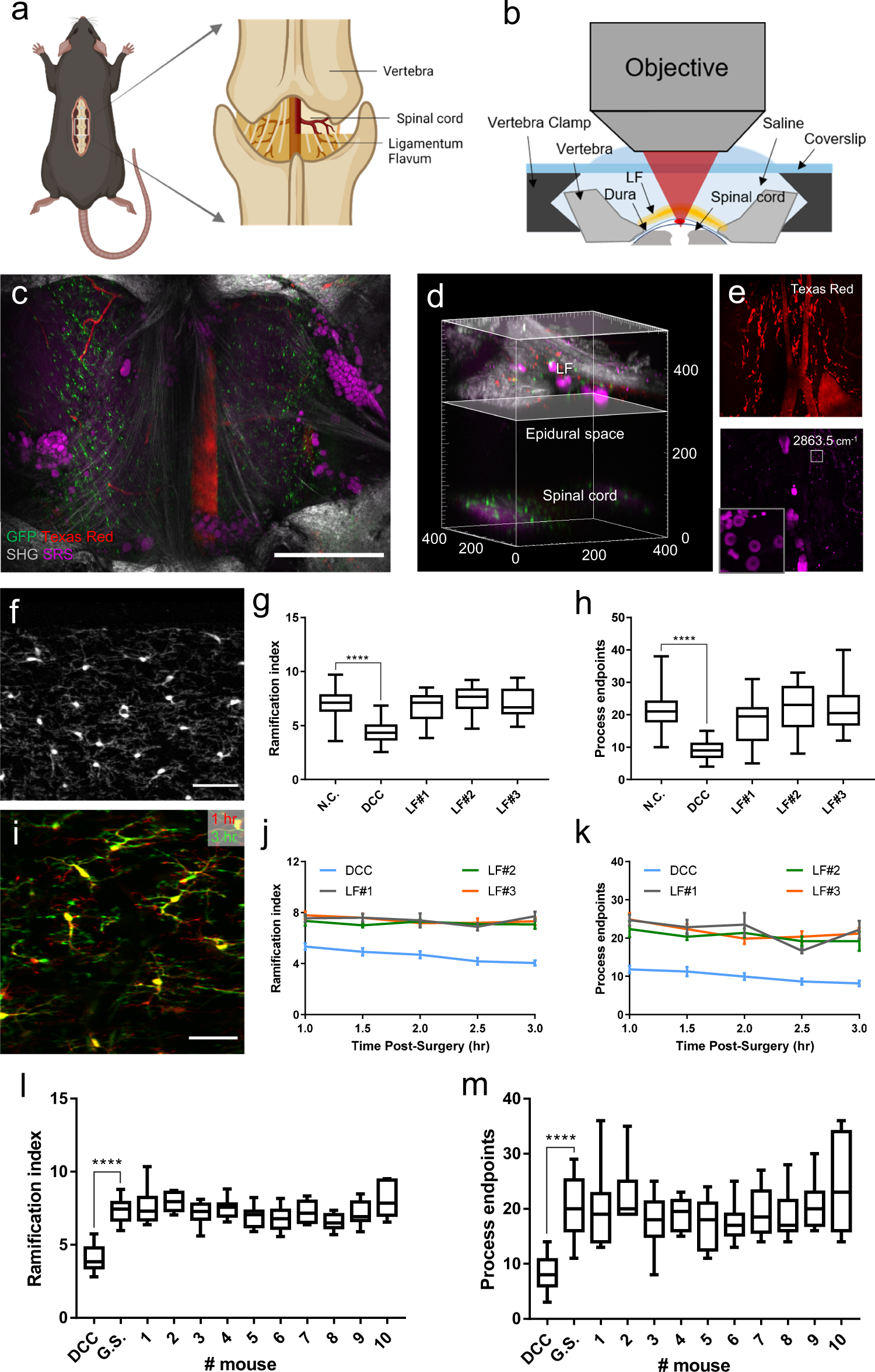 Minimally invasive longitudinal intravital imaging of cellular dynamics in  intact long bone