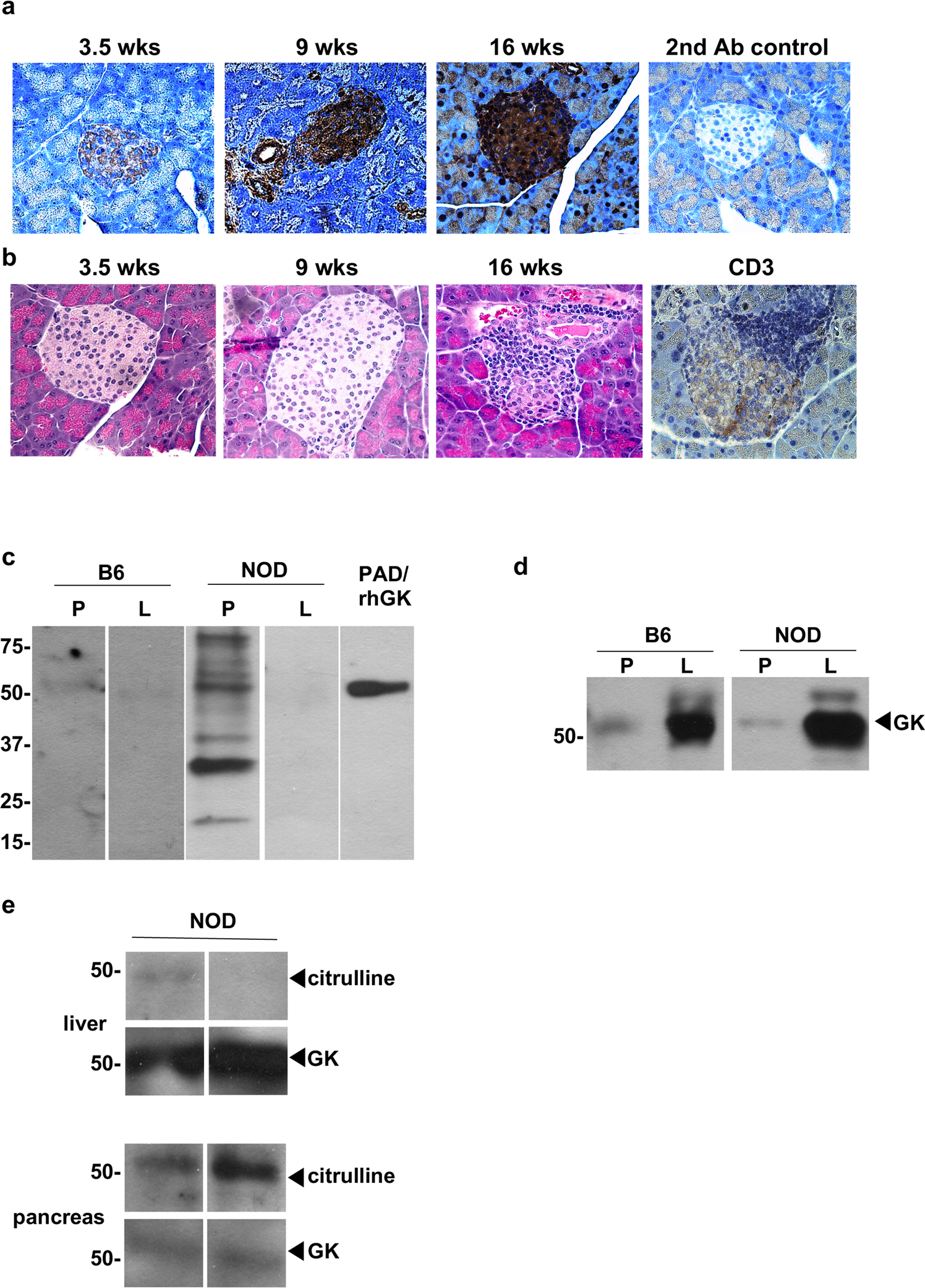 Citrullination Of Glucokinase Is Linked To Autoimmune Diabetes Nature Communications