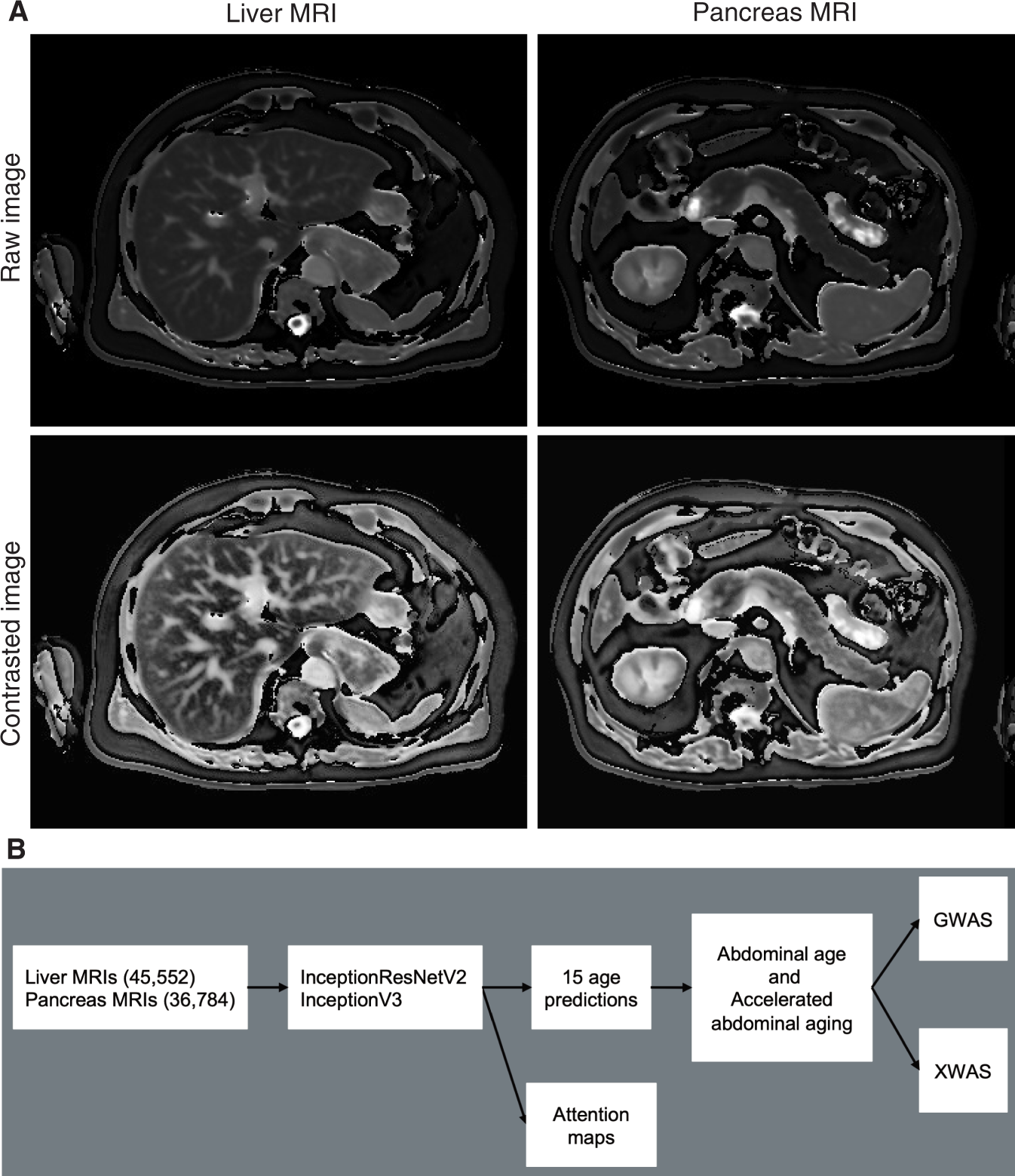 Using Deep Learning To Predict Abdominal Age From Liver And Pancreas Magnetic Resonance Images Nature Communications