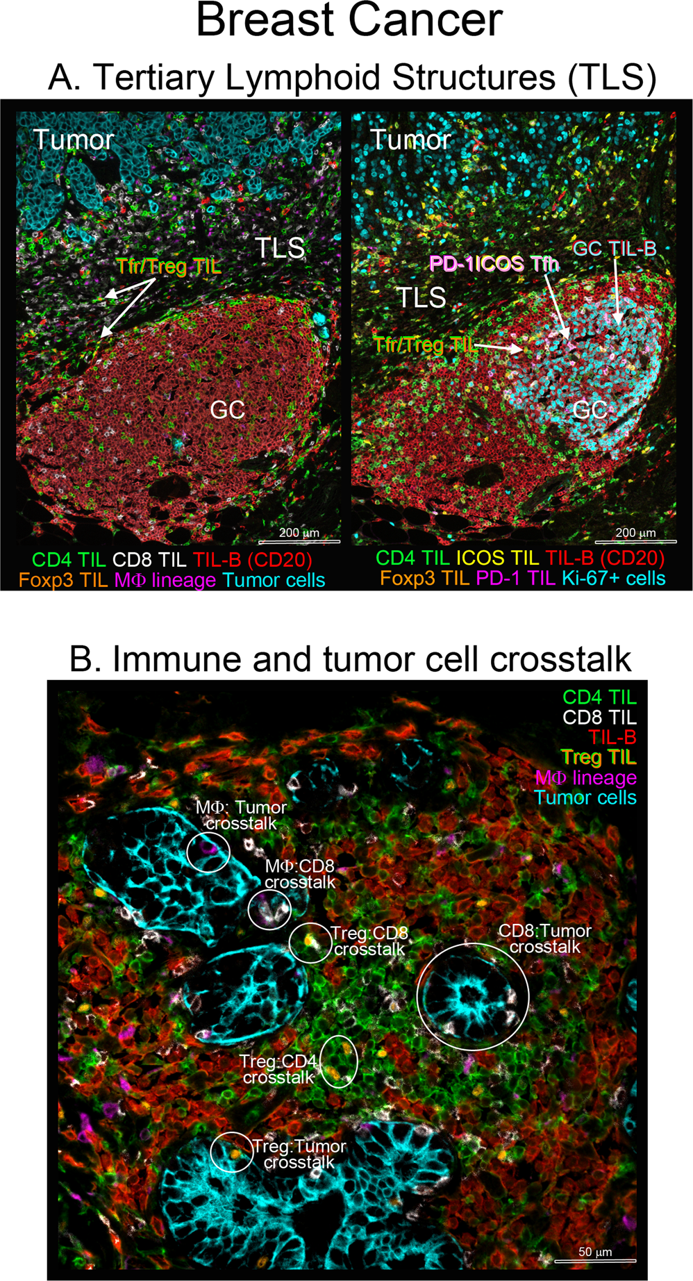 T Follicular Helper And B Cell Crosstalk In Tertiary Lymphoid Structures And Cancer Immunotherapy Nature Communications