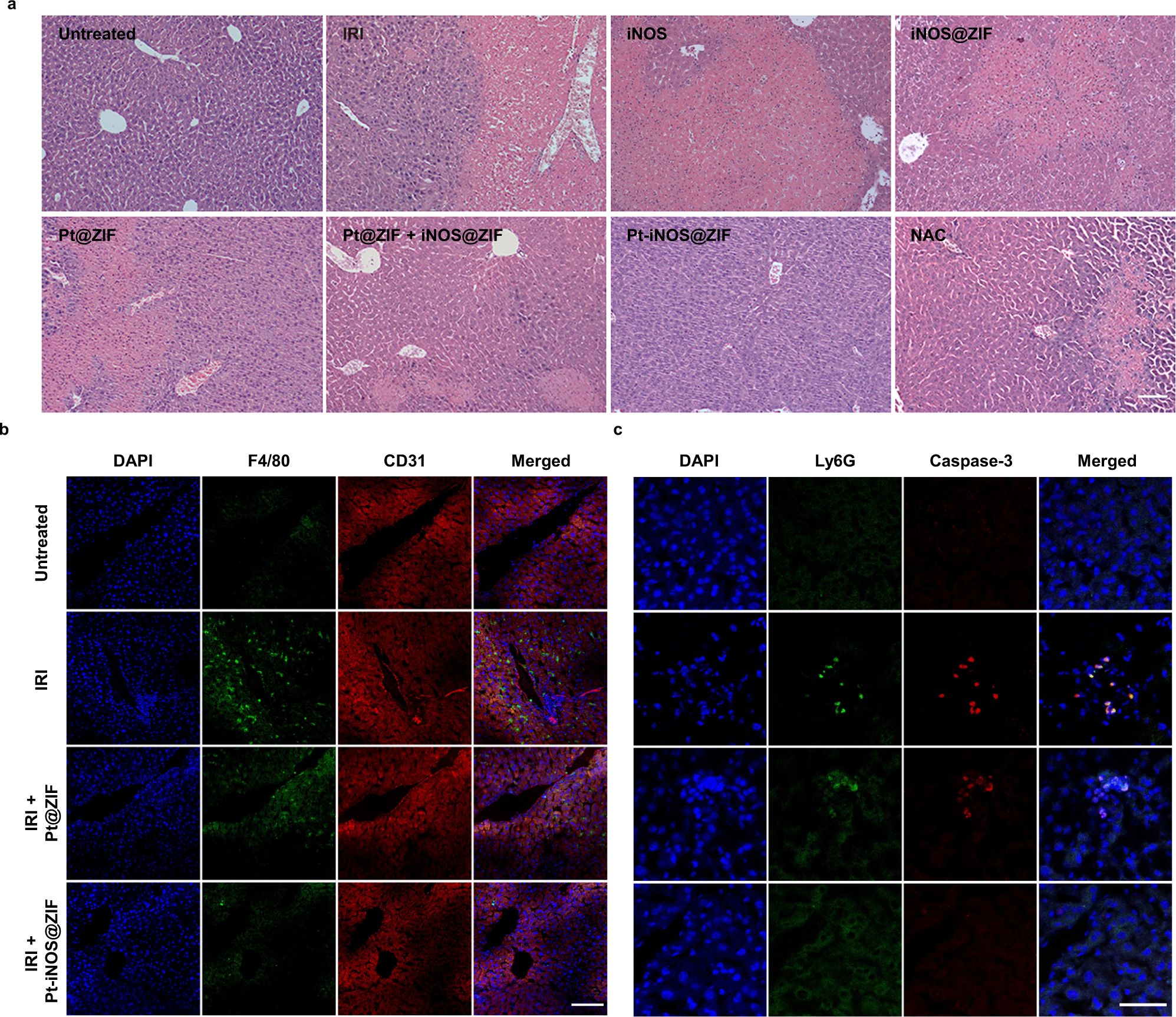 Fig. 6: H&E and Immunofluorescence staining on liver tissues.