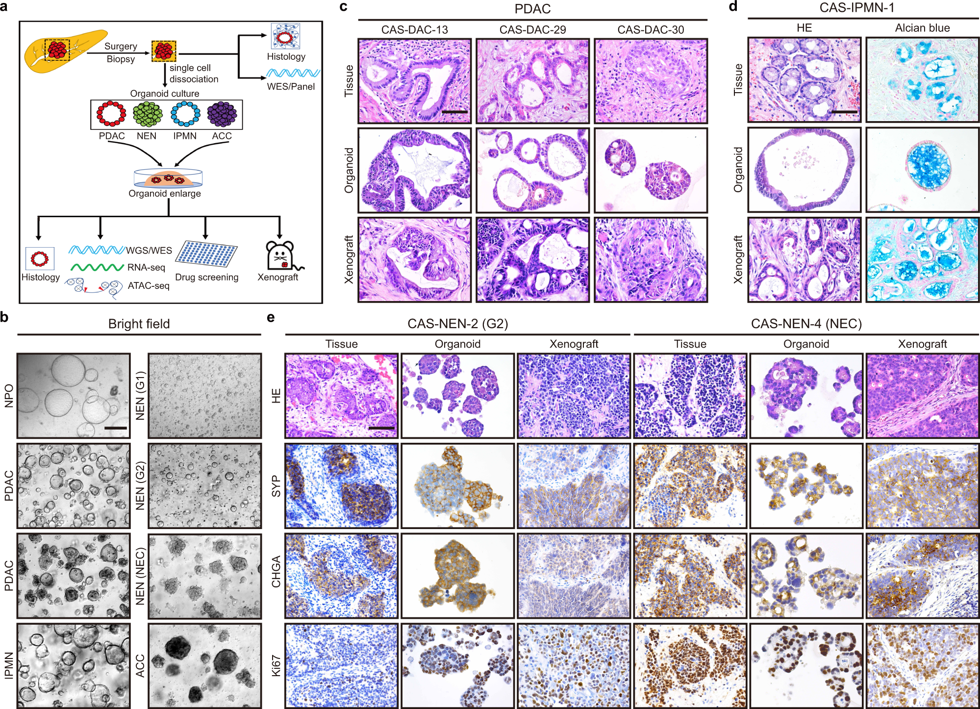 Integrated profiling of human pancreatic cancer organoids reveals chromatin  accessibility features associated with drug sensitivity | Nature  Communications