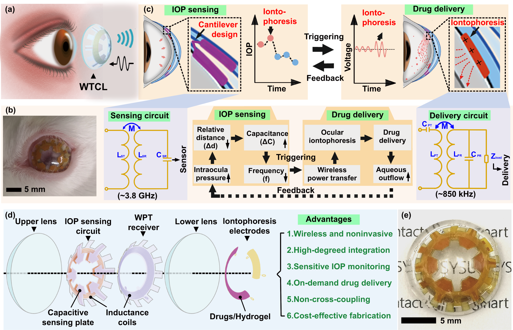 kreupel Omleiden Alarmerend Intelligent wireless theranostic contact lens for electrical sensing and  regulation of intraocular pressure | Nature Communications