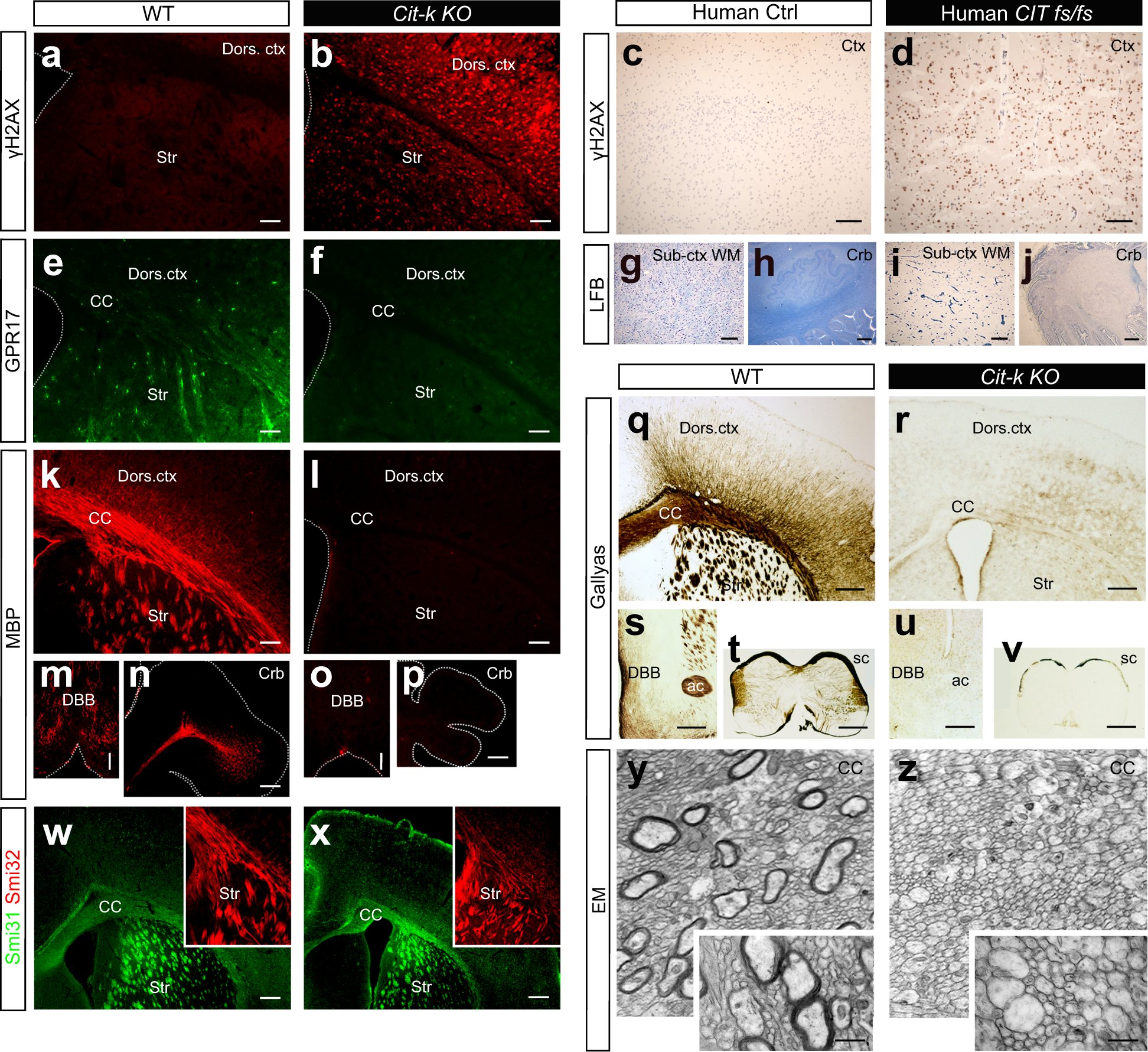 Molecular and functional heterogeneity in dorsal and ventral  oligodendrocyte progenitor cells of the mouse forebrain in response to DNA  damage | Nature Communications