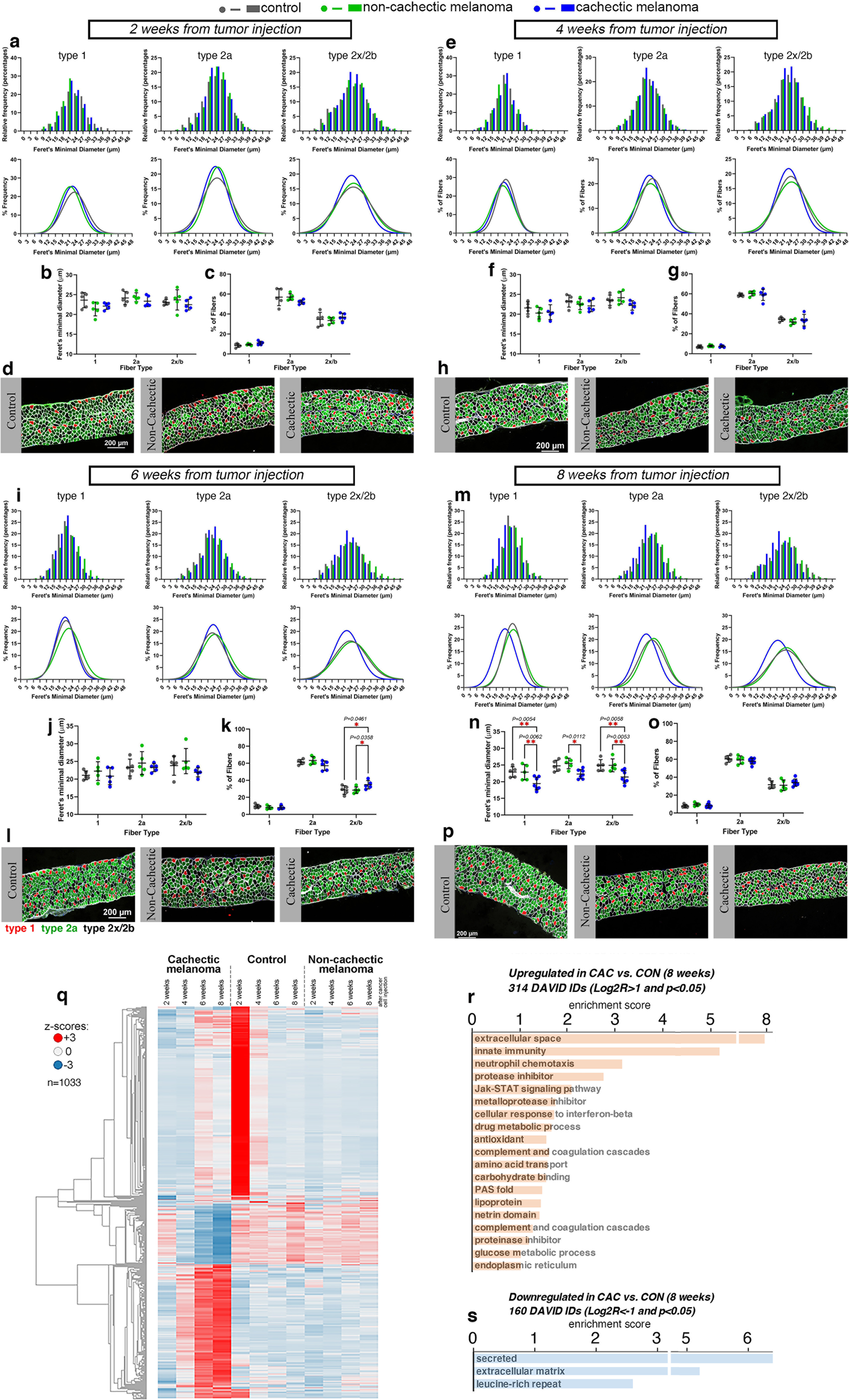 Fig. 5: Cachexia caused by a pediatric melanoma xenograft induces myofiber atrophy in the diaphragm.
