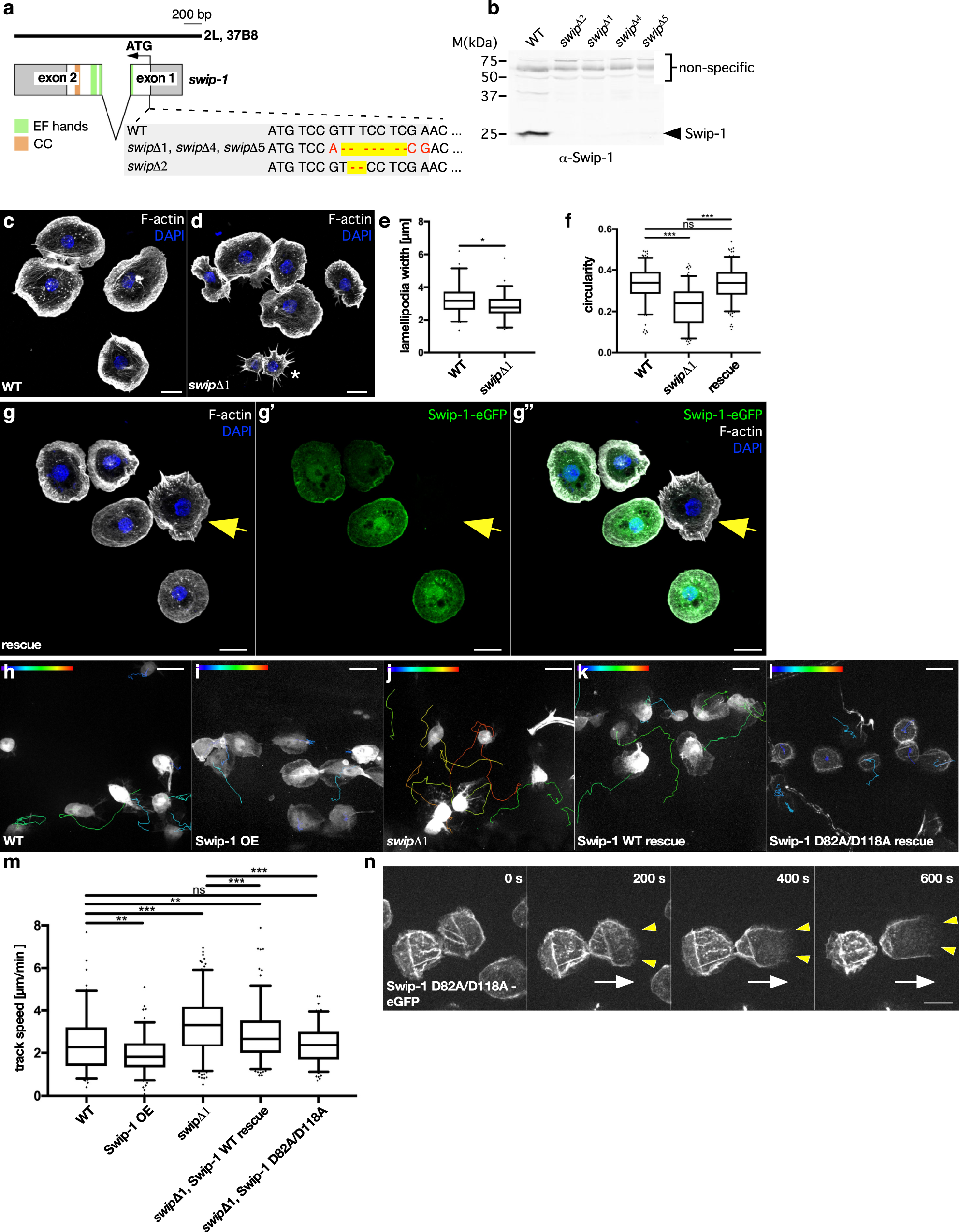Fig. 2: Loss of Swip-1 impairs lamellipodia formation and cell migration of macrophages.
