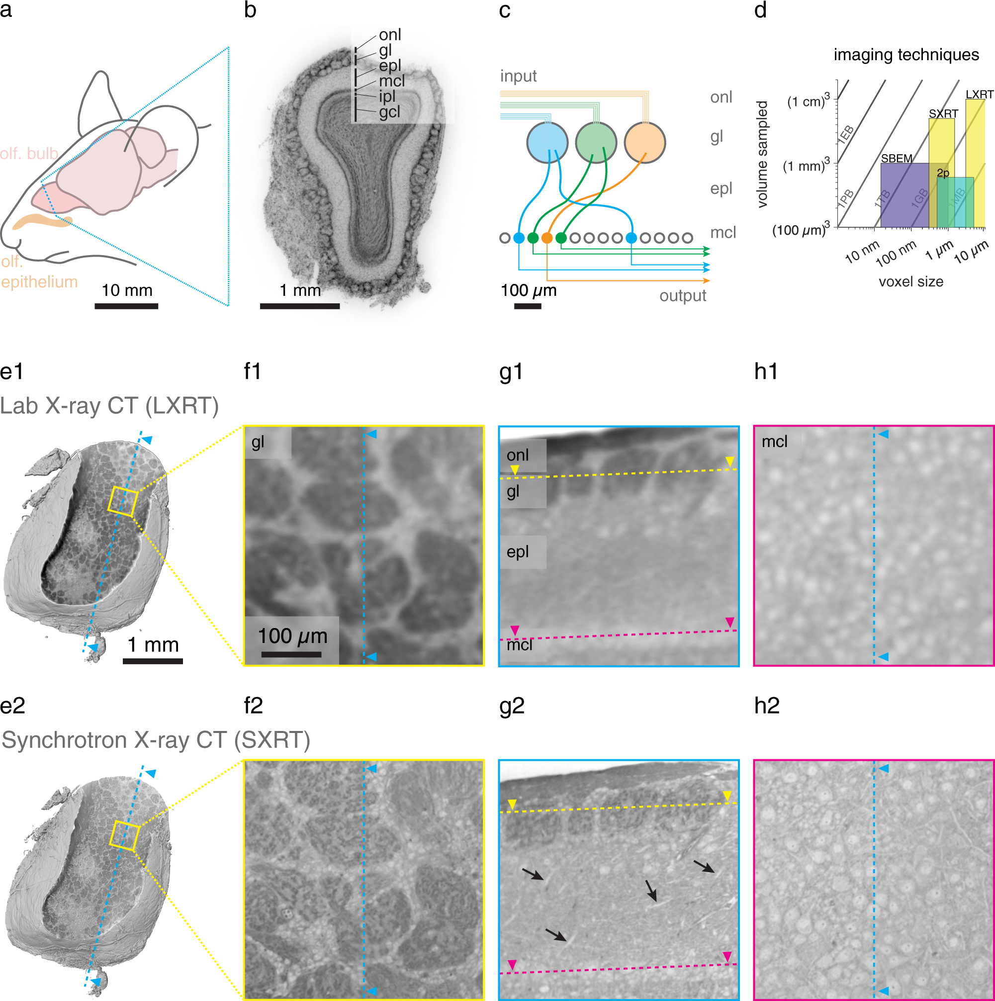 Functional and multiscale 3D structural investigation of brain tissue through correlative in vivo physiology, synchrotron microtomography and volume electron microscopy Nature Communications