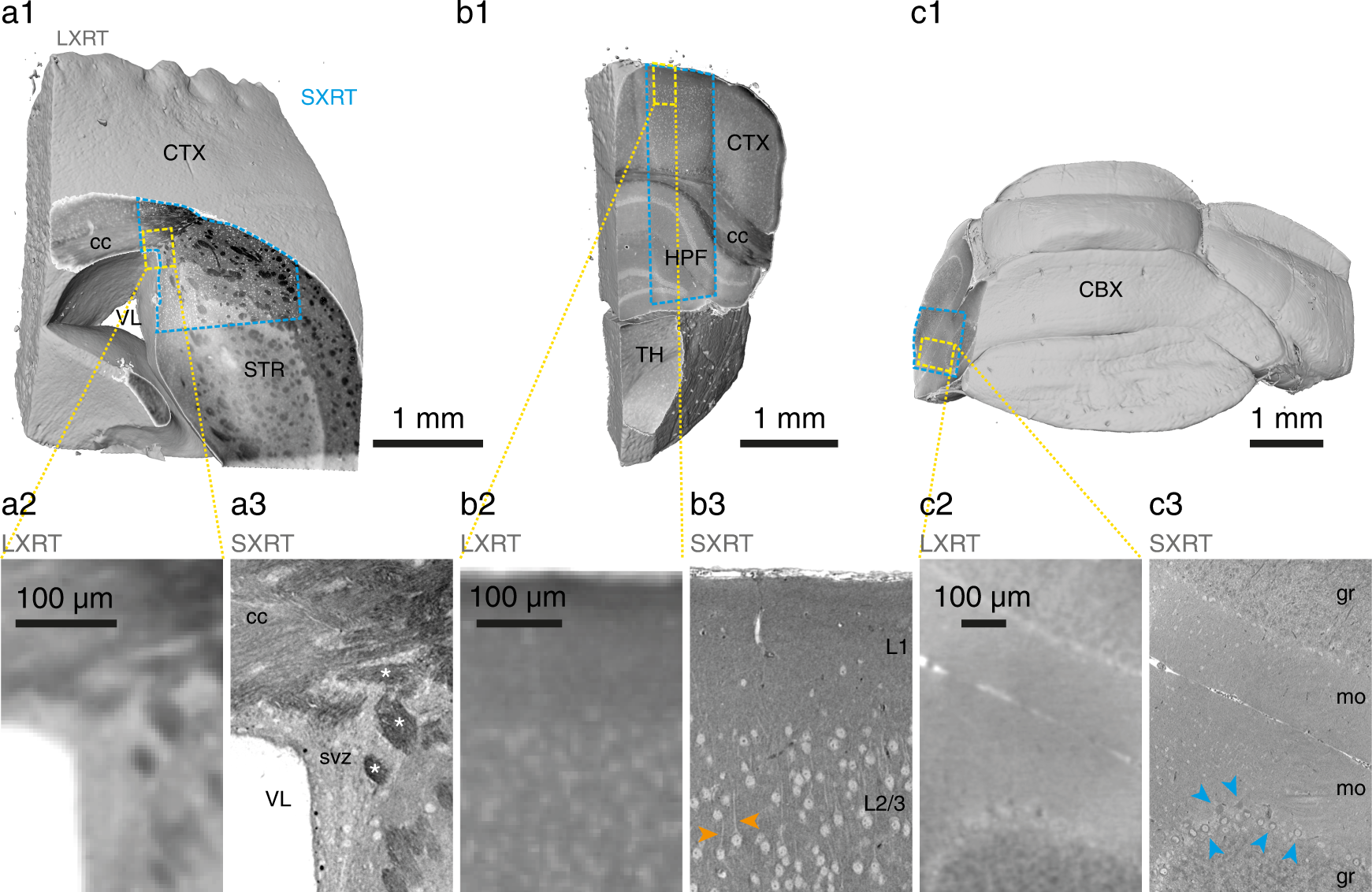 Fig. 5: Subcellular compartments resolved by SXRT in other mouse brain regions.