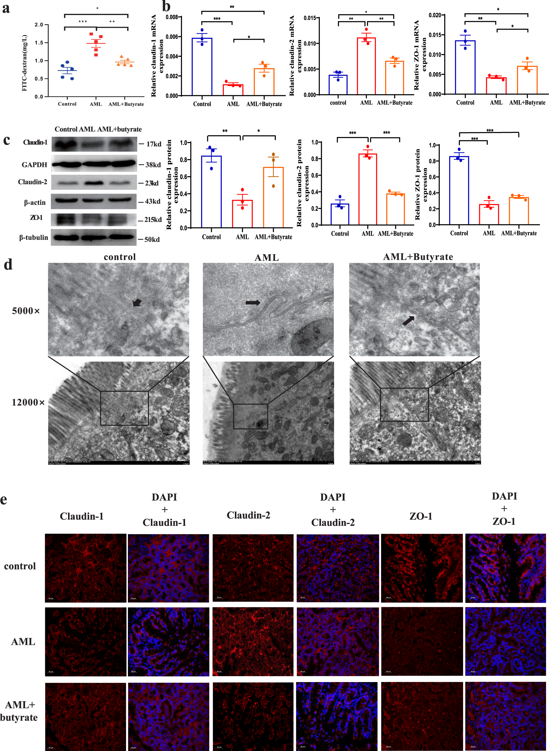 Fig. 6: Butyrate reverses intestinal barrier damage in mice with AML.