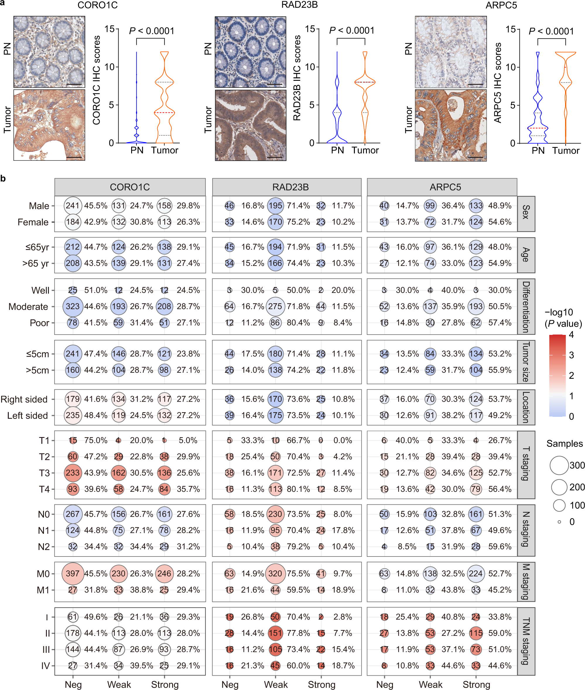 Fig. 5: Immunohistochemical staining of three diagnostic biomarkers in tissues and their clinical significance.