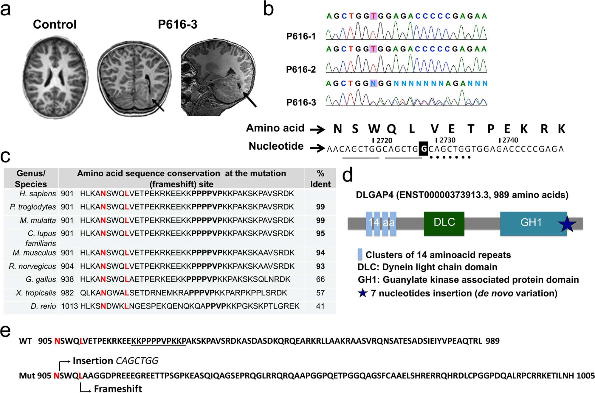 Large-scale neuroanatomical study uncovers 198 gene associations in mouse  brain morphogenesis