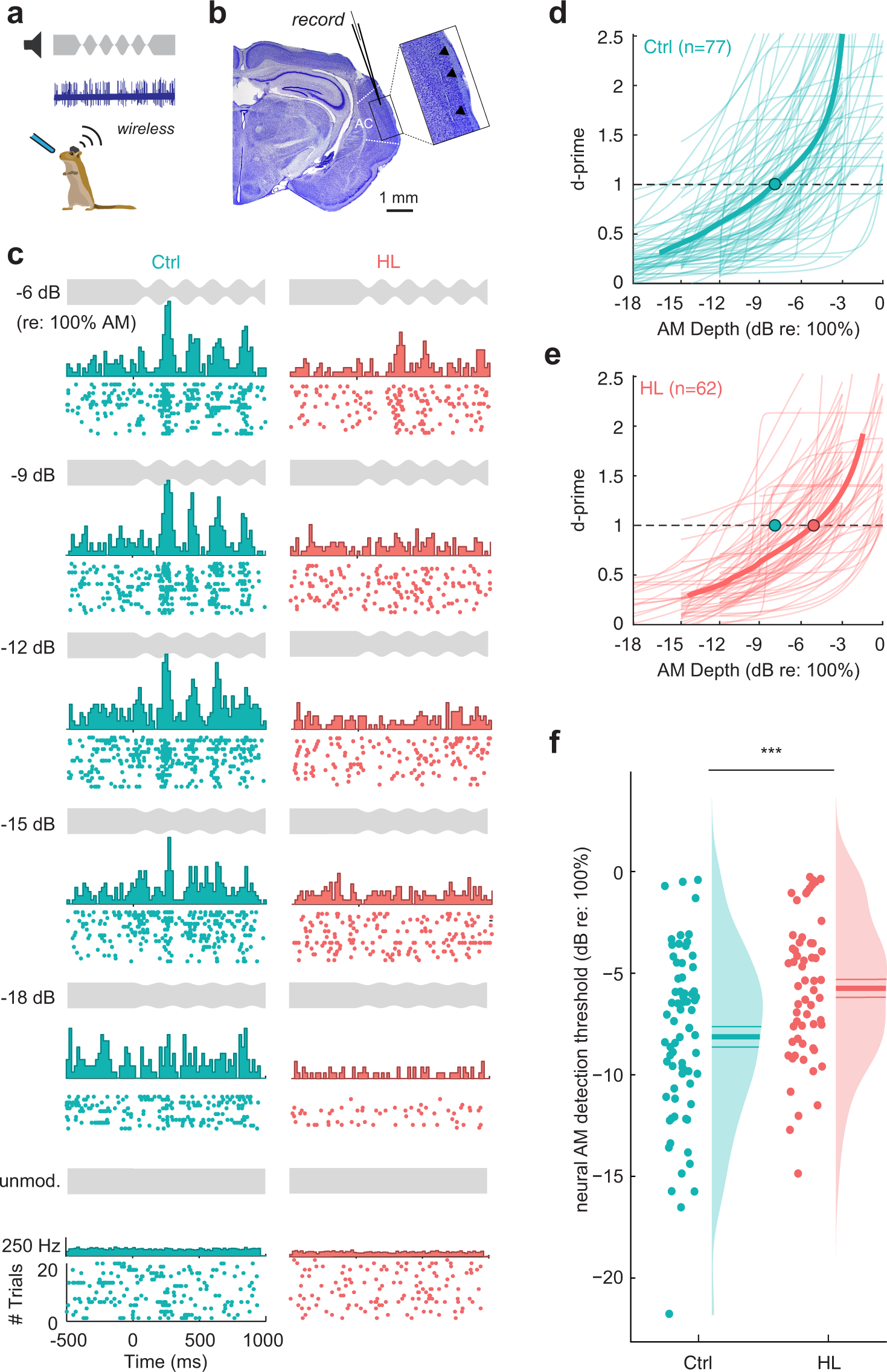 Fig. 5: Single-unit analysis reveals poorer neural detection thresholds in the auditory cortex.
