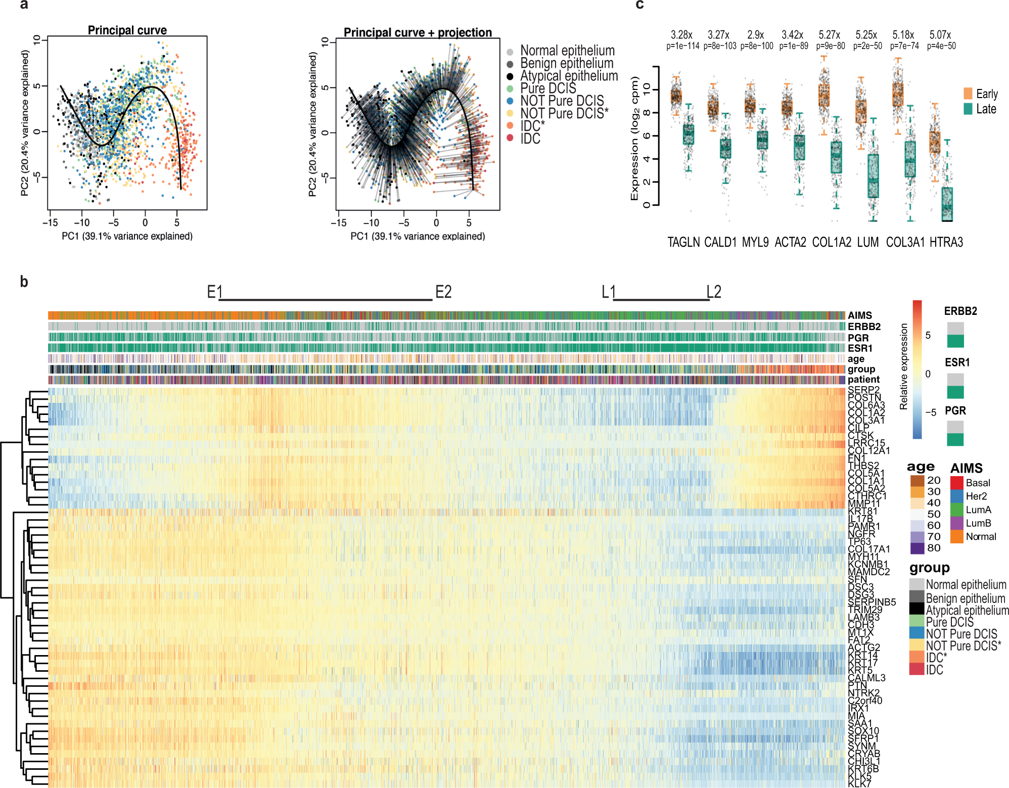 Fig. 3: Generating a pseudo-time for DCIS.
