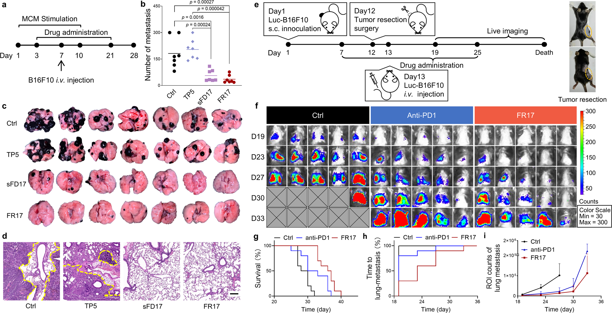 Fig. 6: FR17 administration inhibits lung metastasis in vivo by retarding PMN formation.