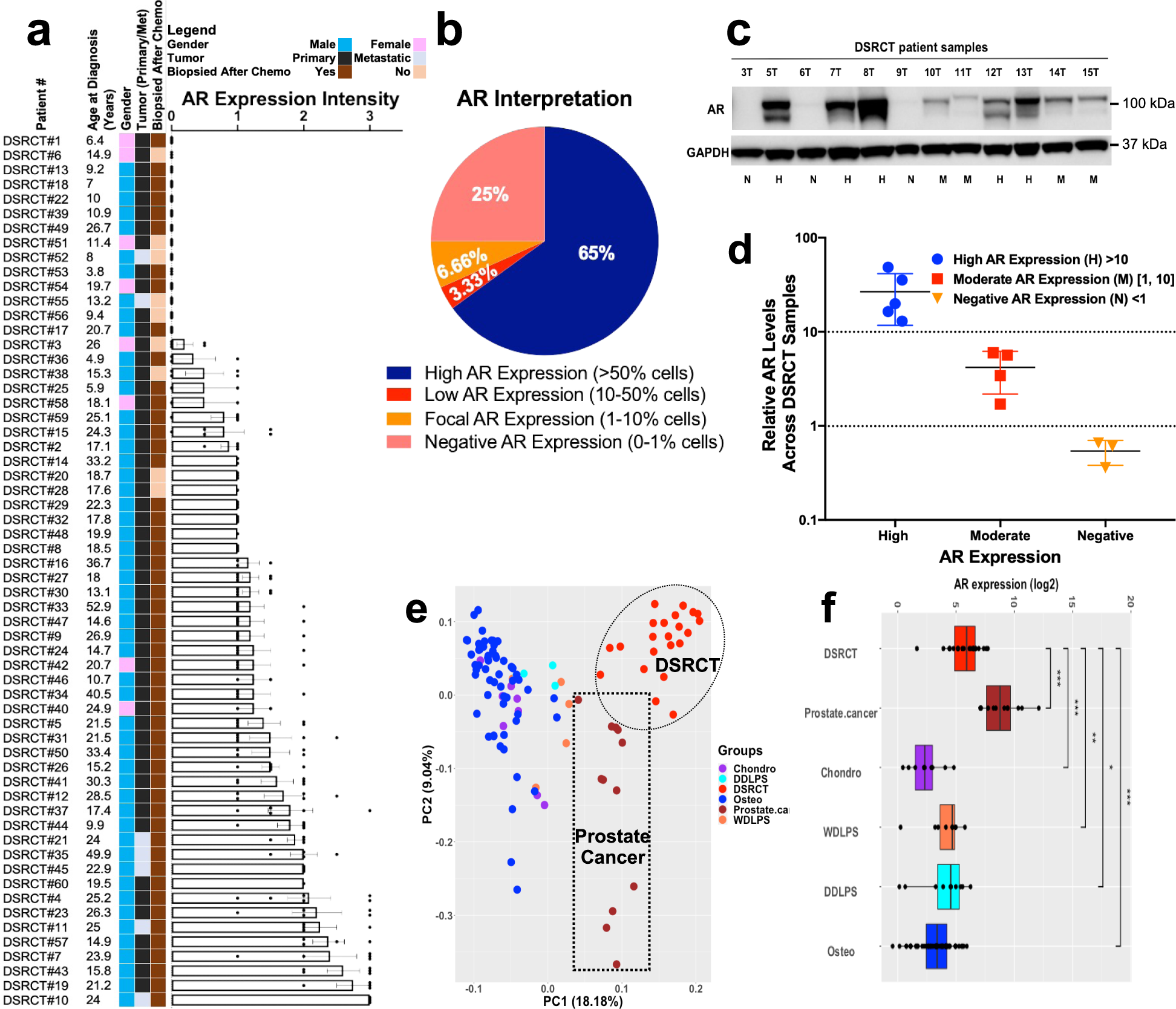 Fig. 2: DSRCT TMA and frozen specimen profiling for AR and PSA expression.
