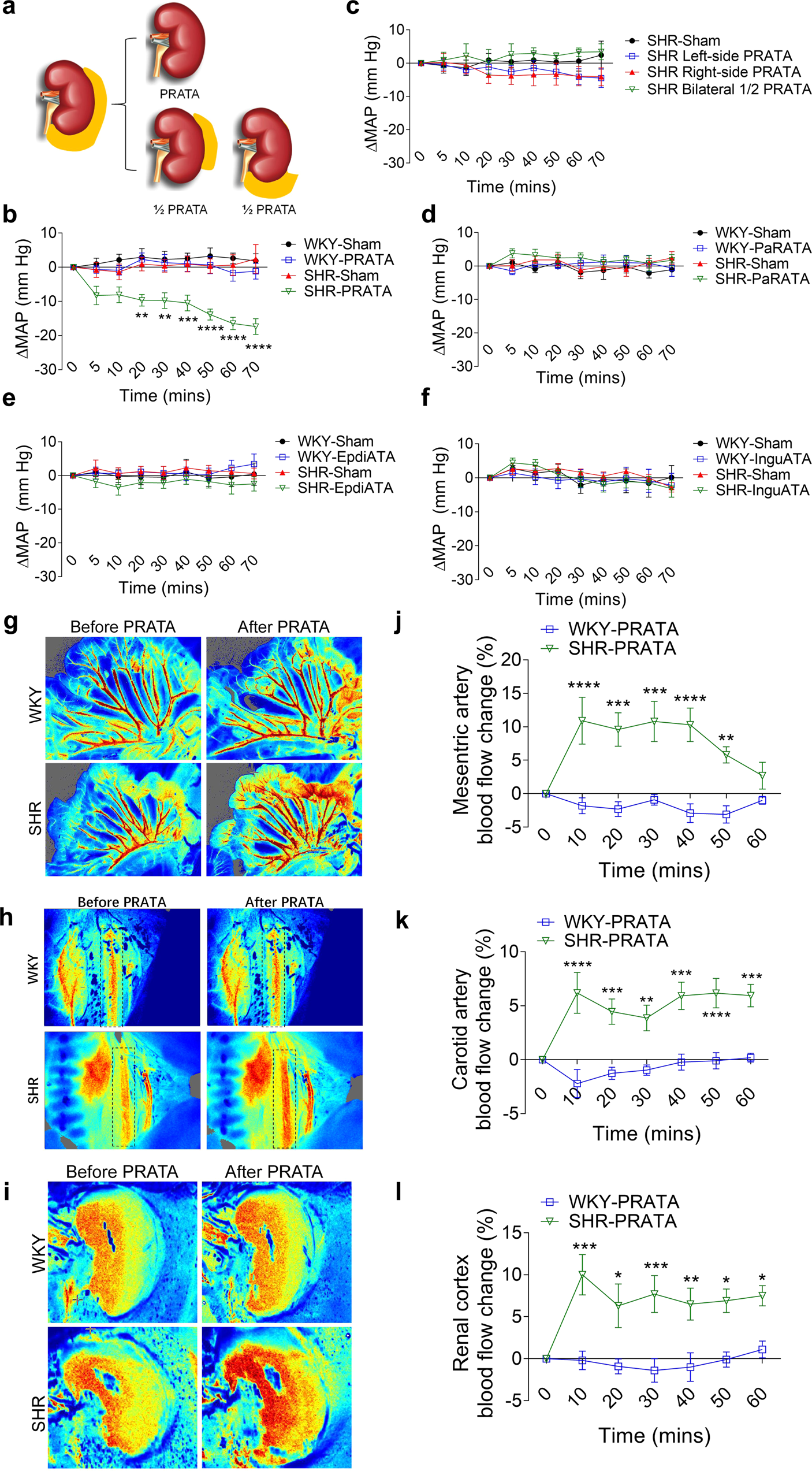 Perirenal adipose afferent nerves sustain pathological high blood pressure  in rats | Nature Communications